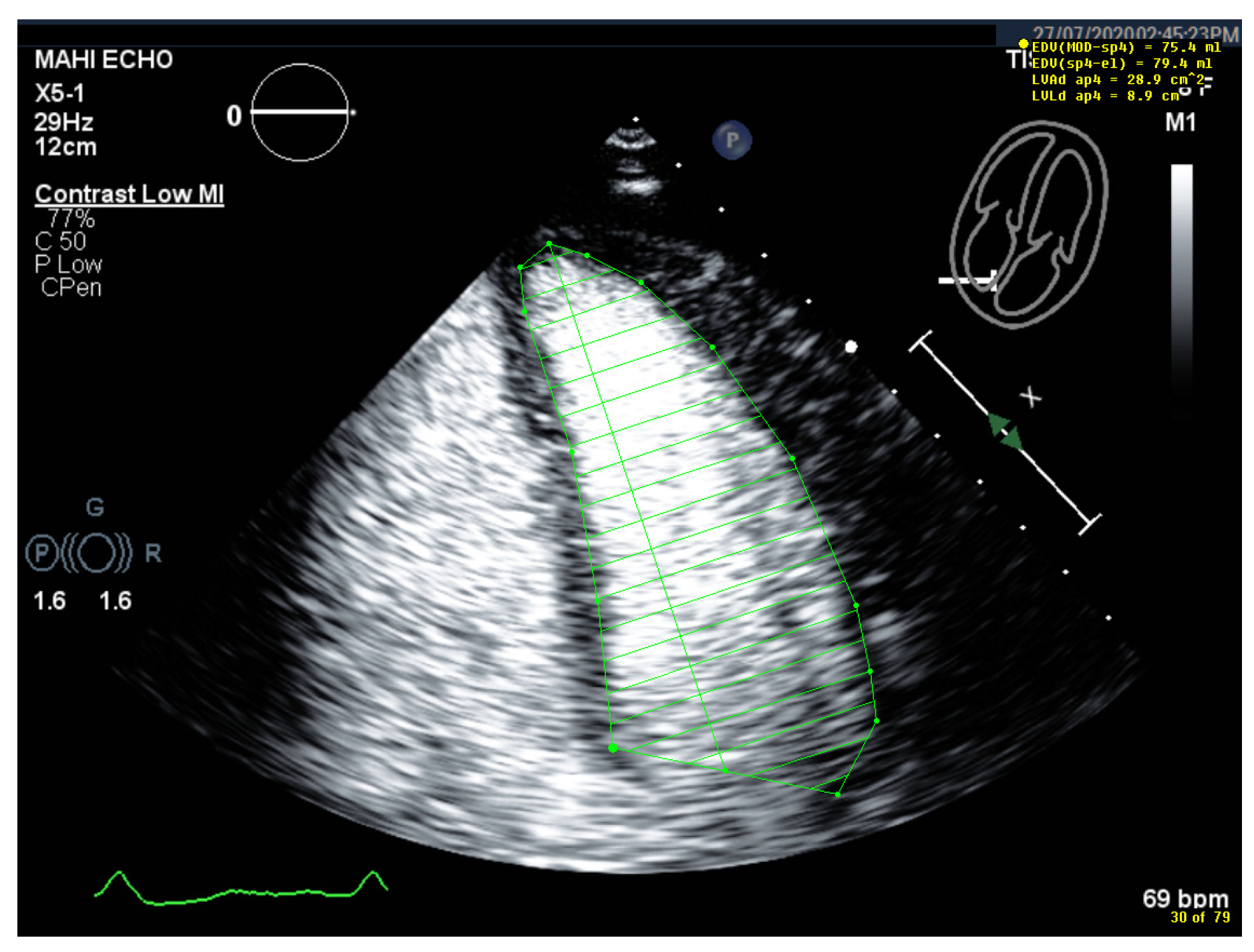 Diagnostics 15 01743 g011 Diagnostics 15 01743 g011