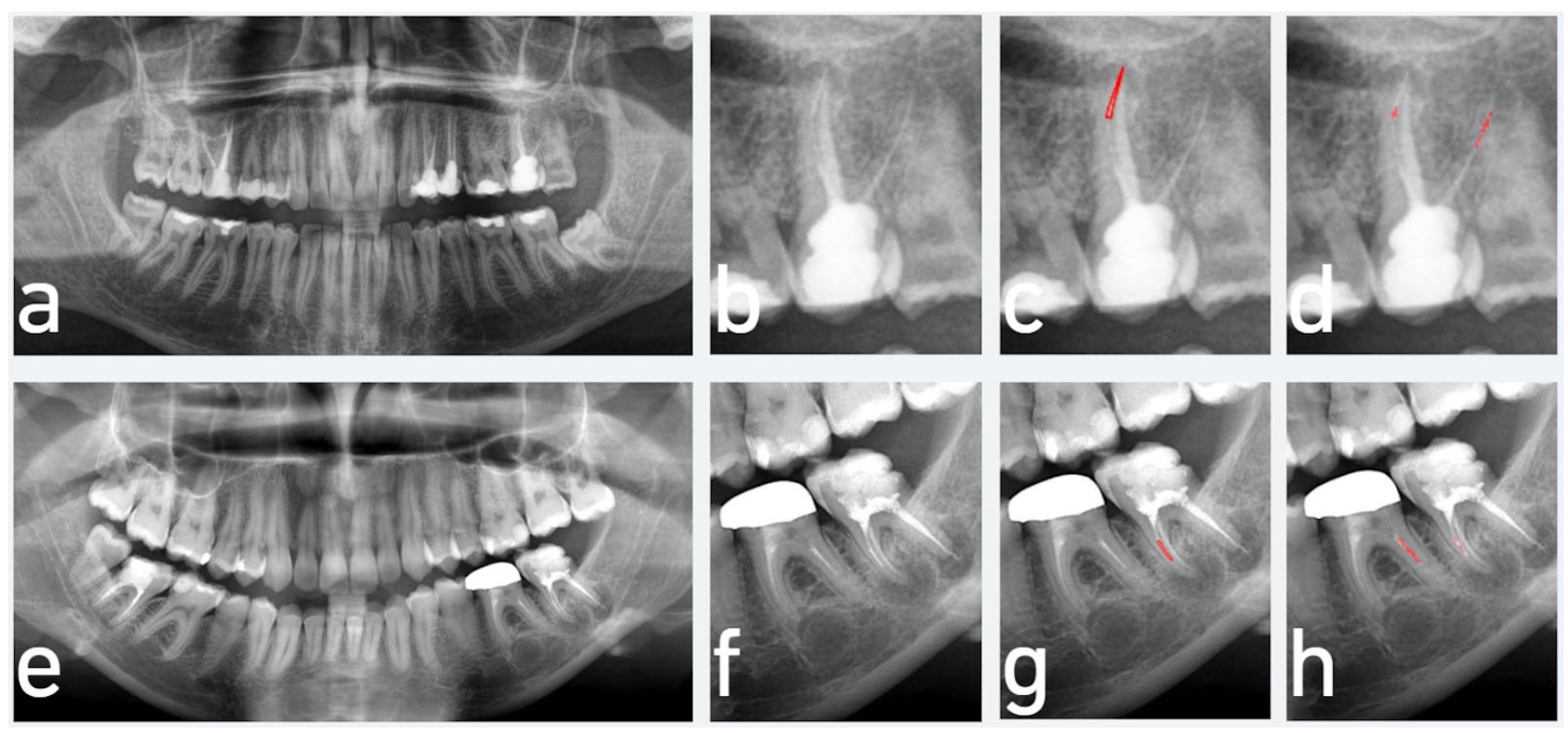 Diagnostics 15 01744 g004