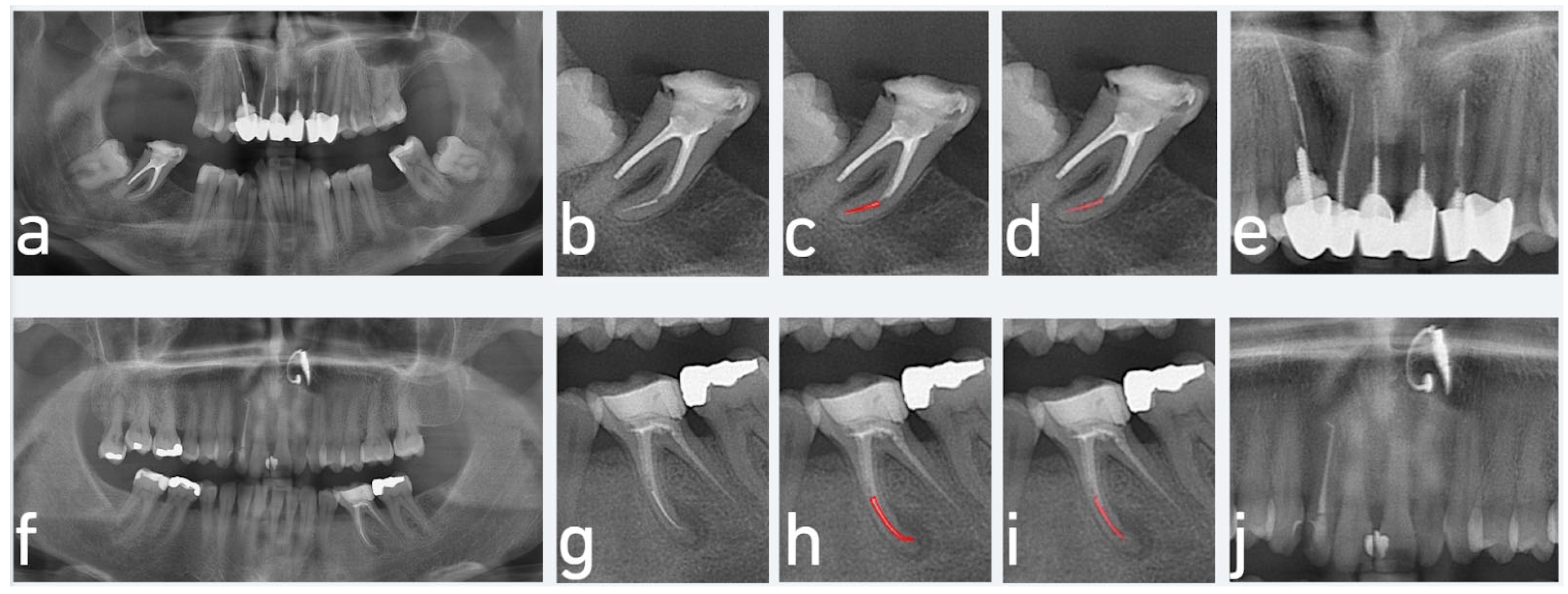 Diagnostics 15 01744 g005
