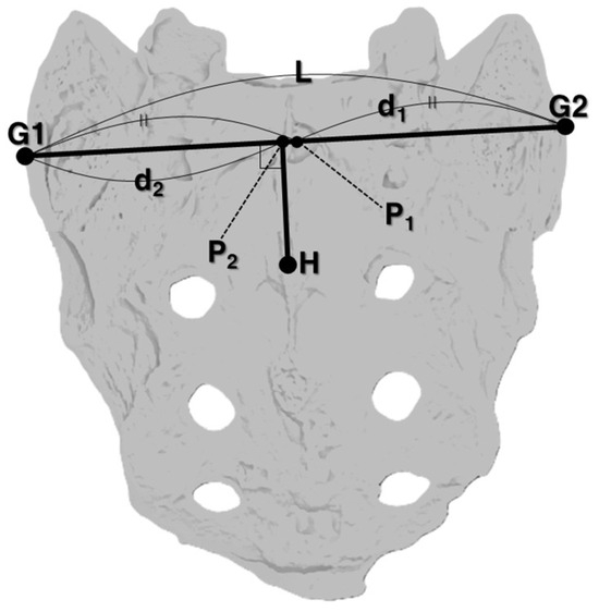 Sacral Rotation Test A Study on the Diagnosis of Lumbar Spinal Malposition in Chuna Manual ...