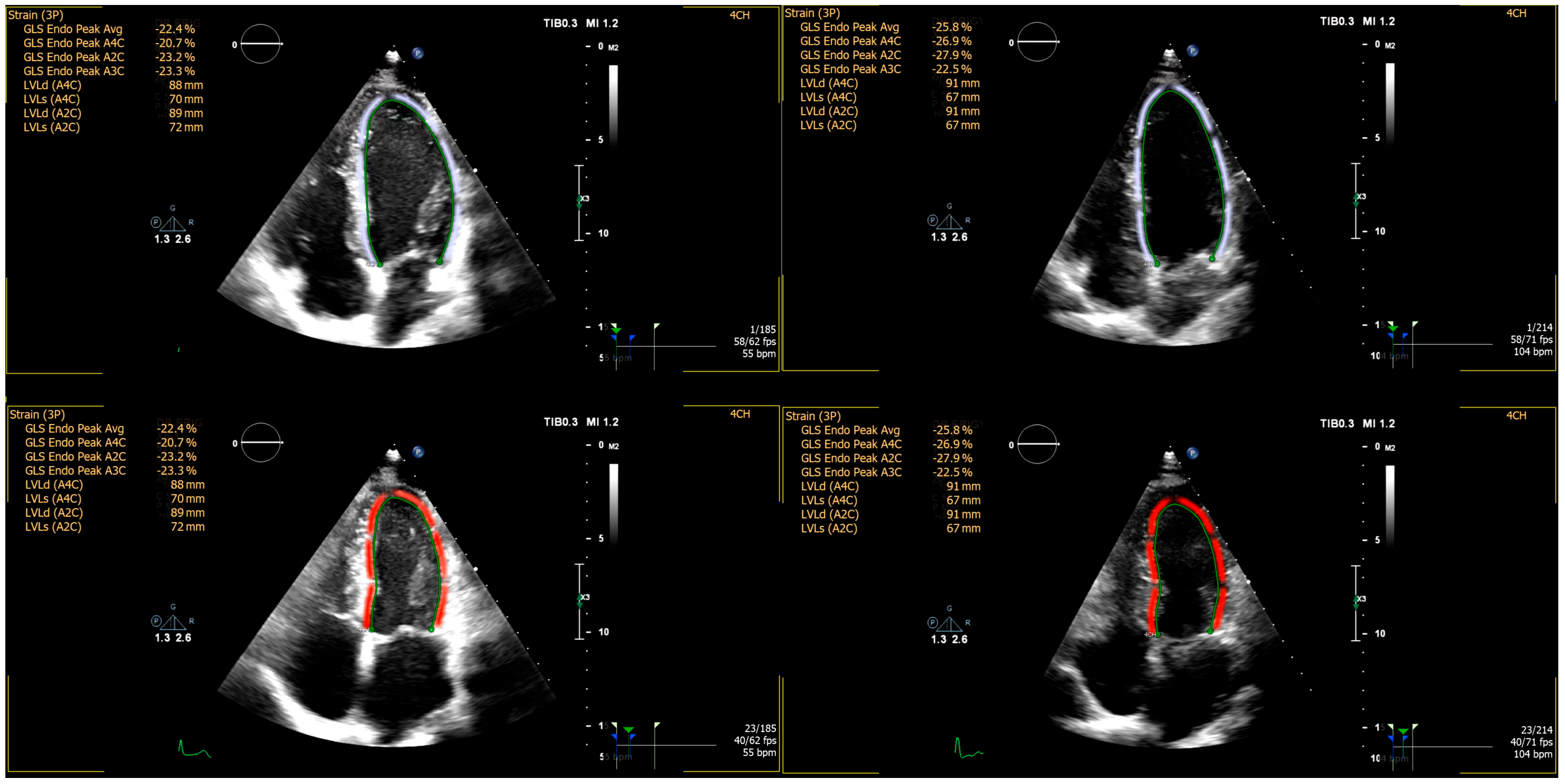 Diagnostics 15 01755 g002 Diagnostics 15 01755 g002