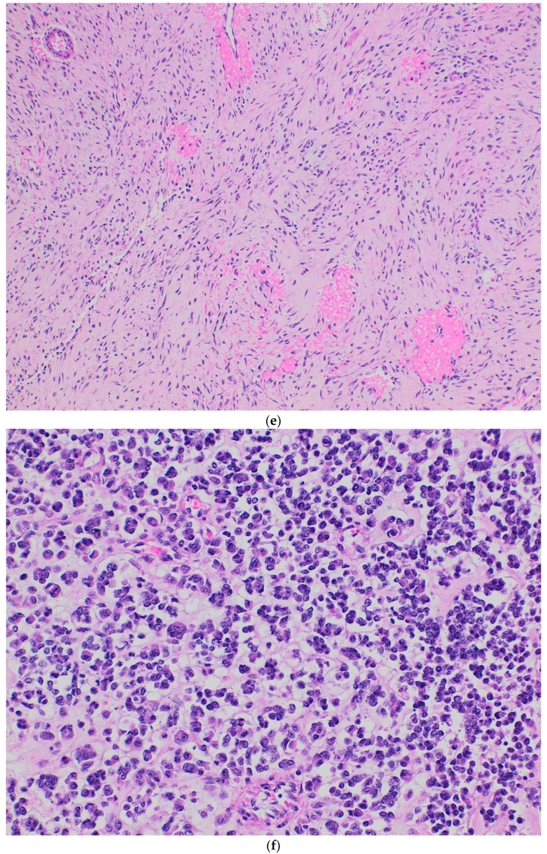 Diagnostics 15 01758 g002c