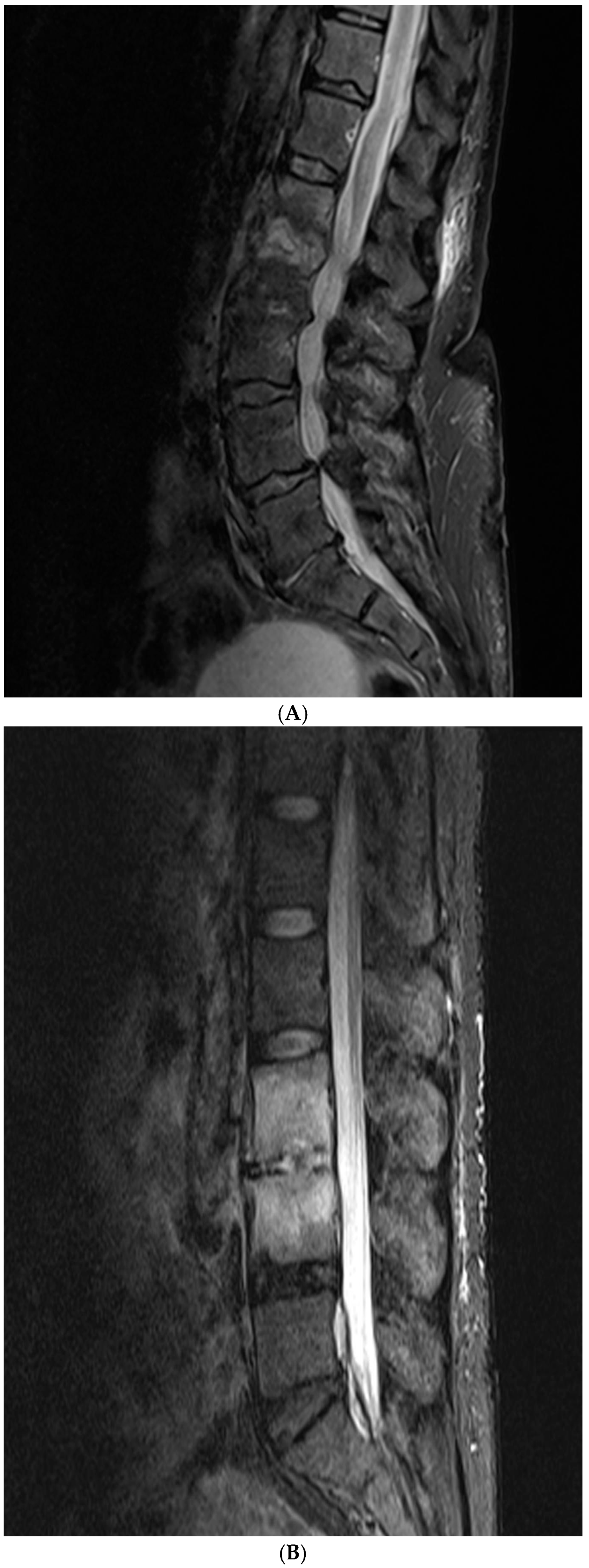Diagnostics 15 01760 g002a