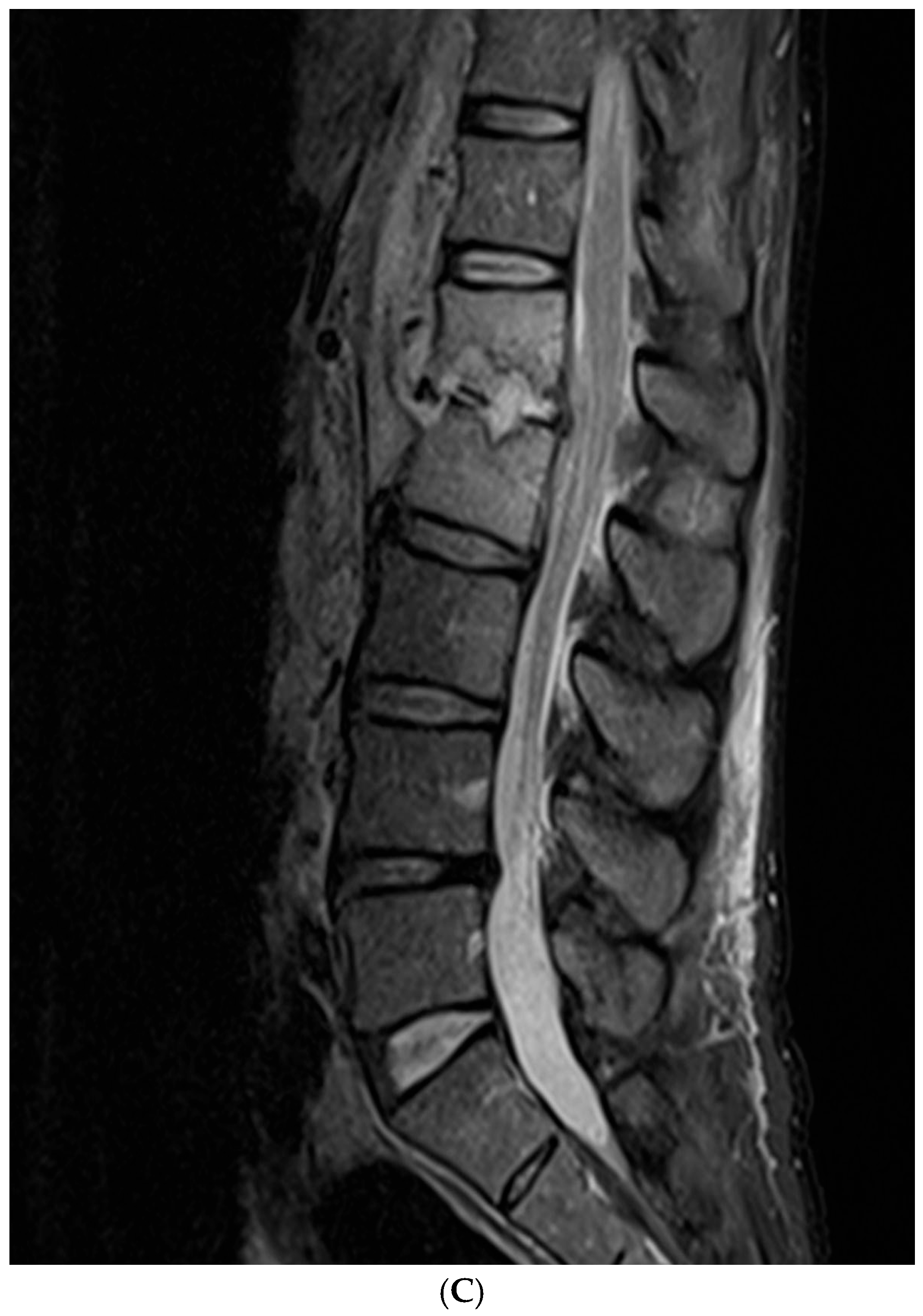 Diagnostics 15 01760 g002b