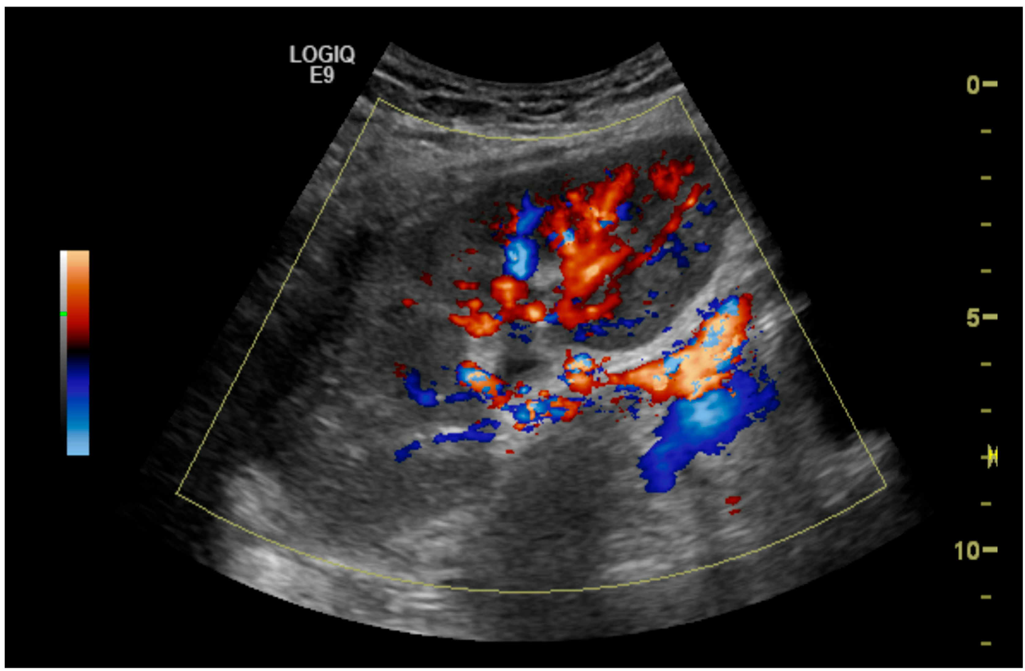 Diagnostics 15 01766 g001 Diagnostics 15 01766 g001