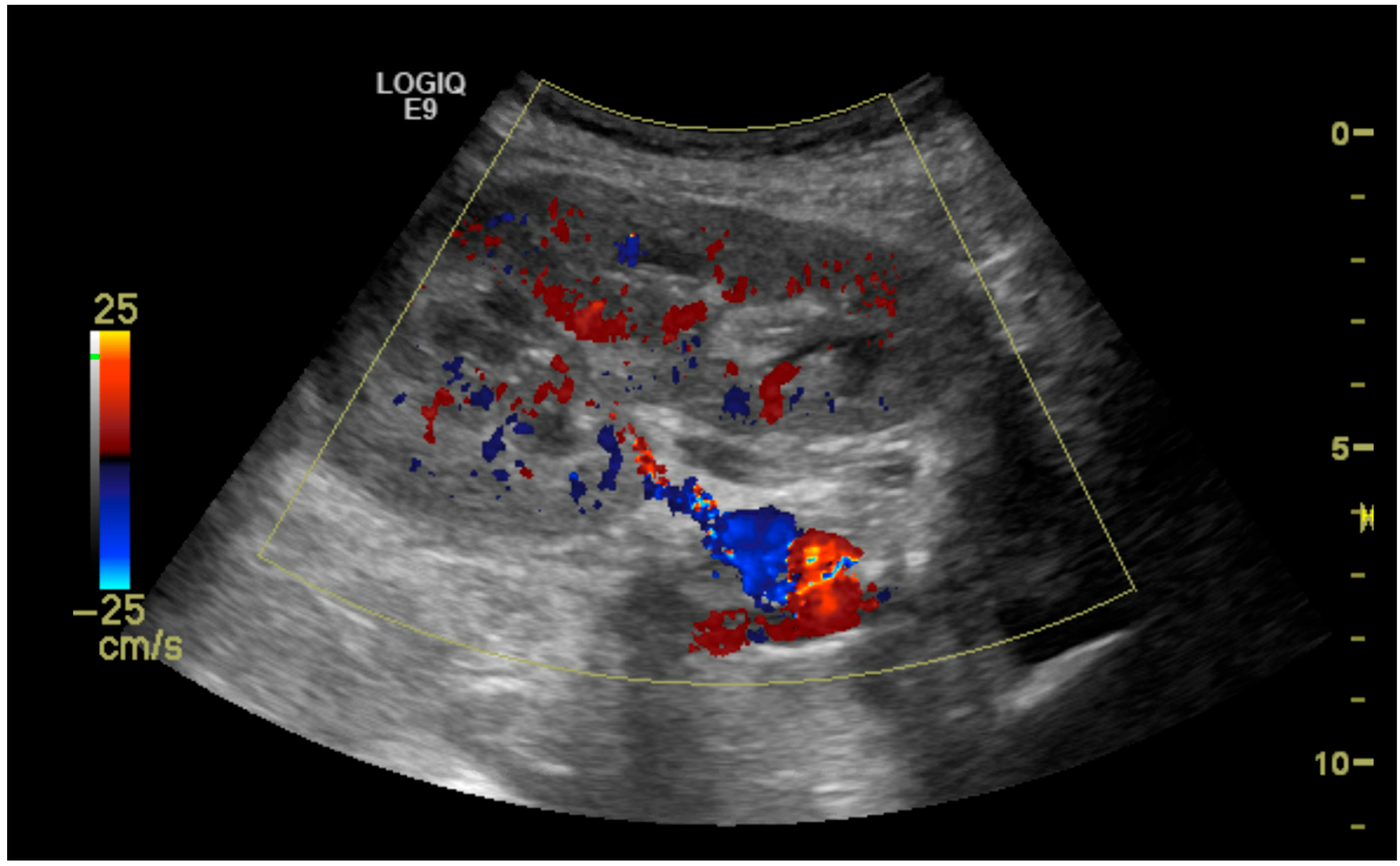 Diagnostics 15 01766 g004 Diagnostics 15 01766 g004