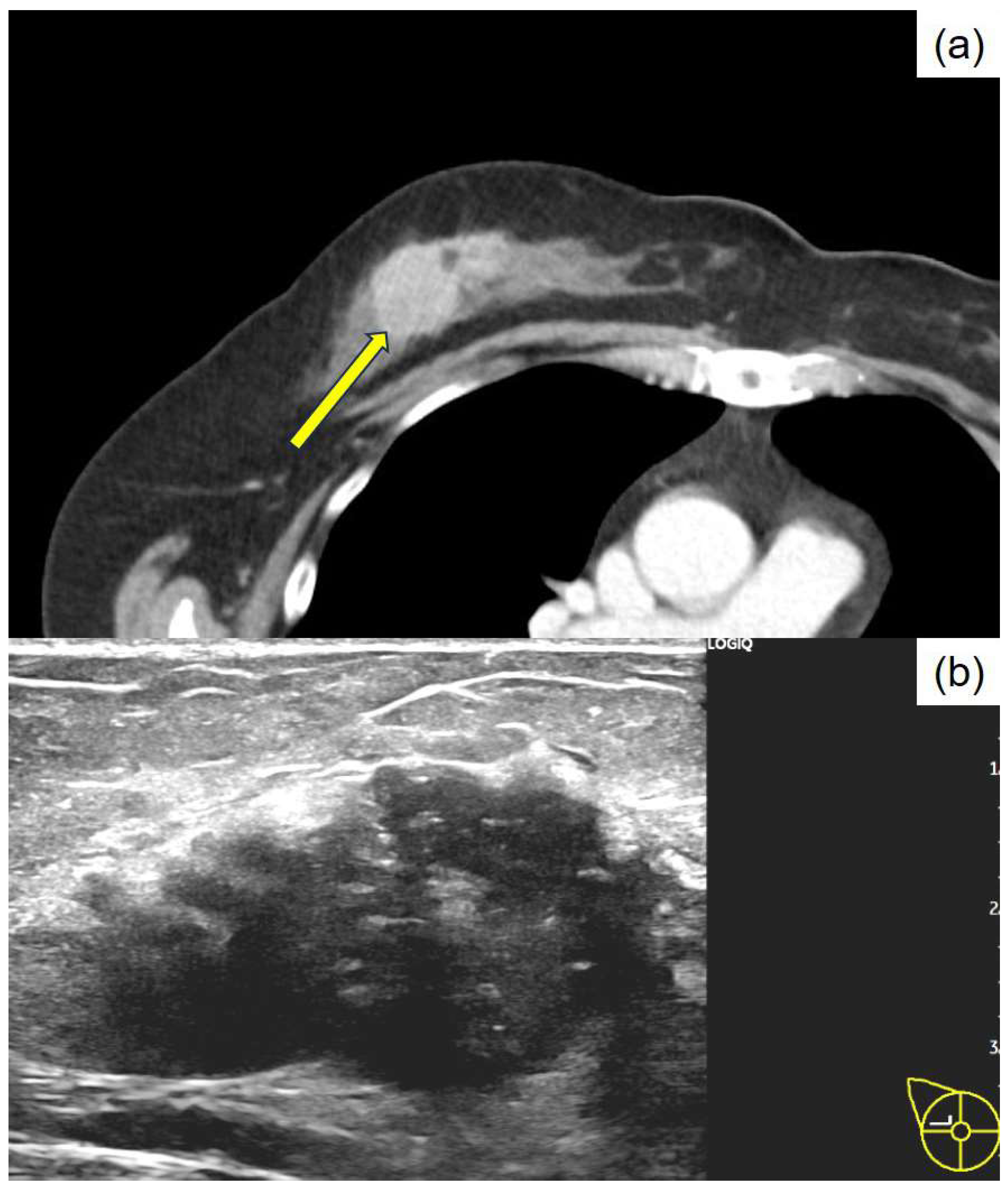 Diagnostics 15 01768 g001
