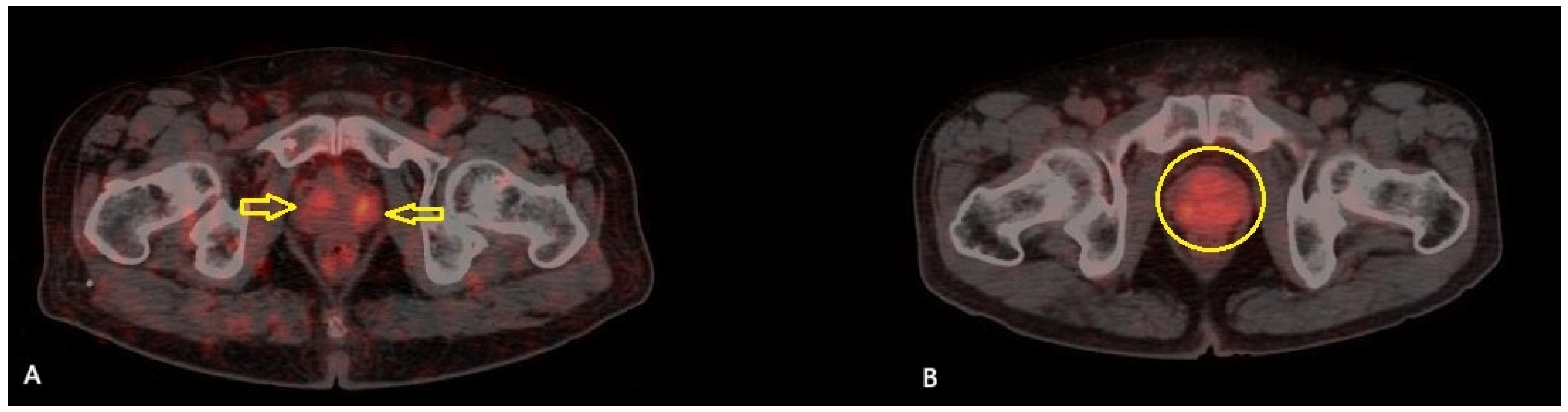 Diagnostics 15 01779 g001