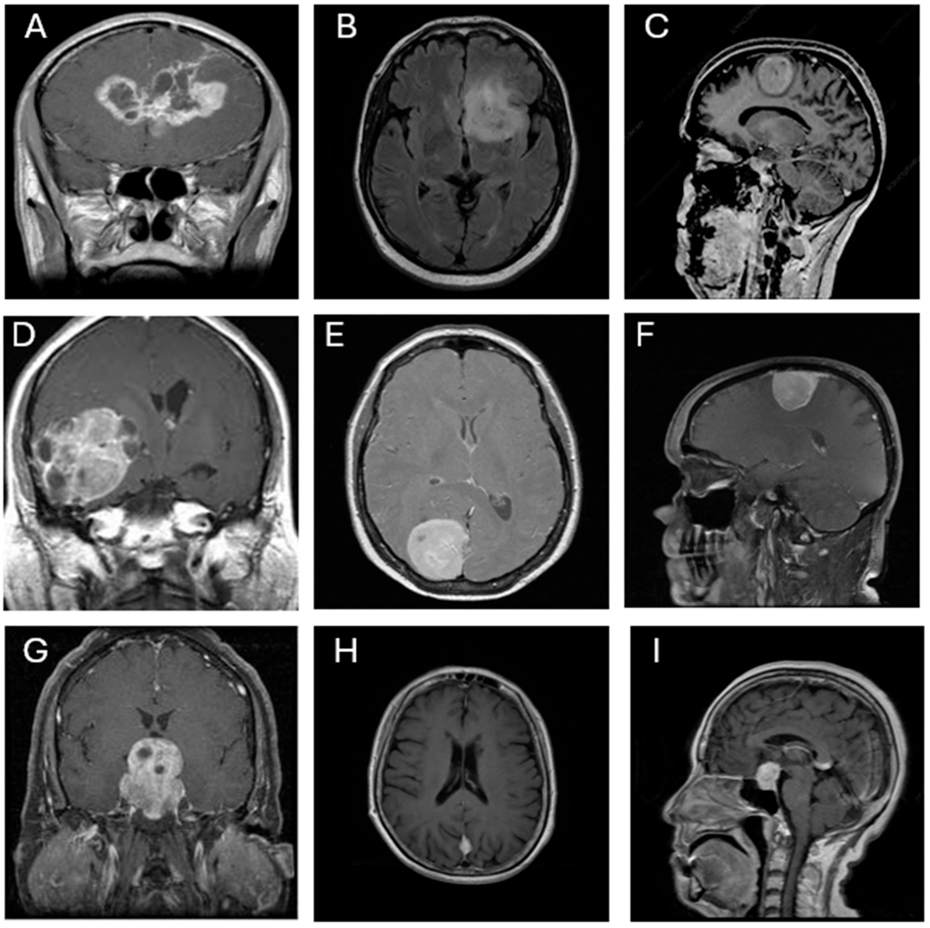Diagnostics 15 01782 g001
