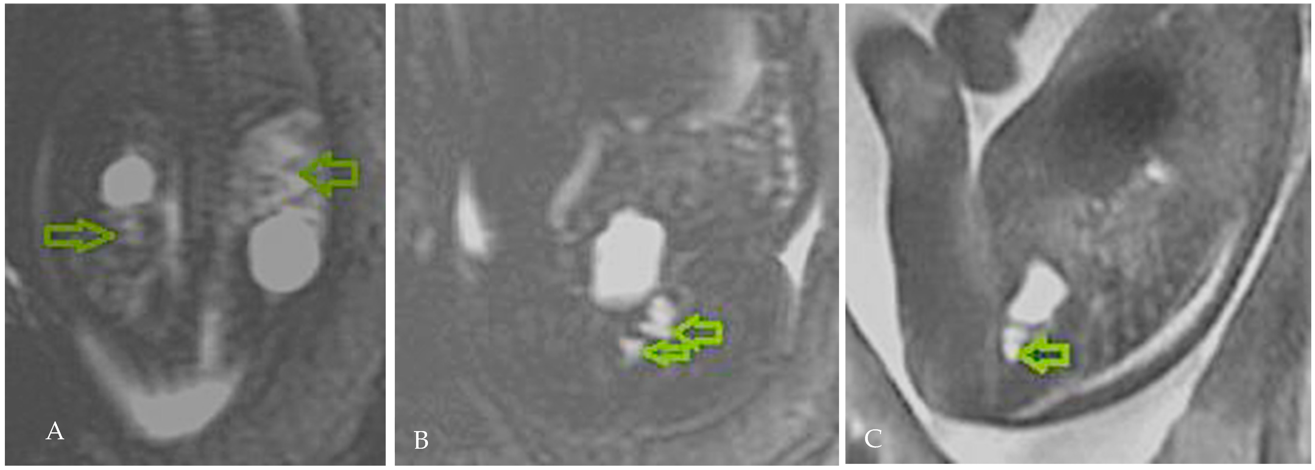 Diagnostics 15 01788 g002 Diagnostics 15 01788 g002