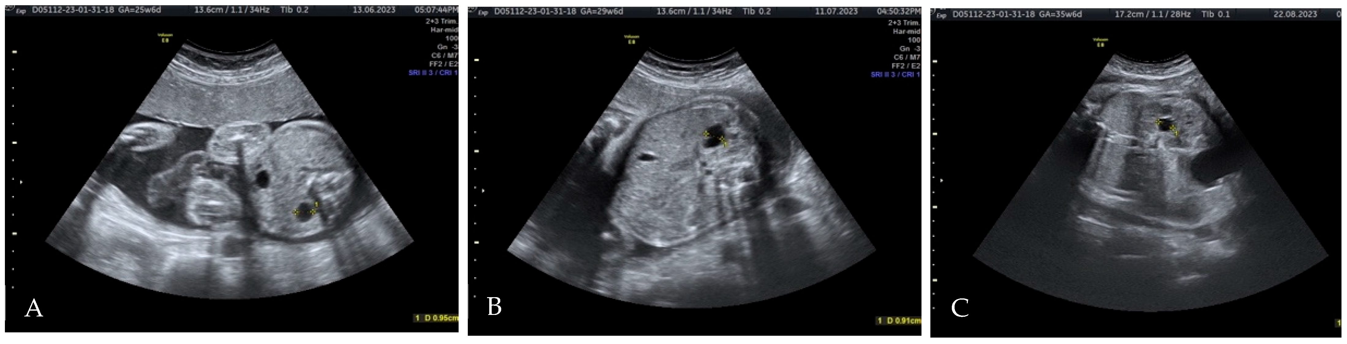 Diagnostics 15 01788 g003 Diagnostics 15 01788 g003