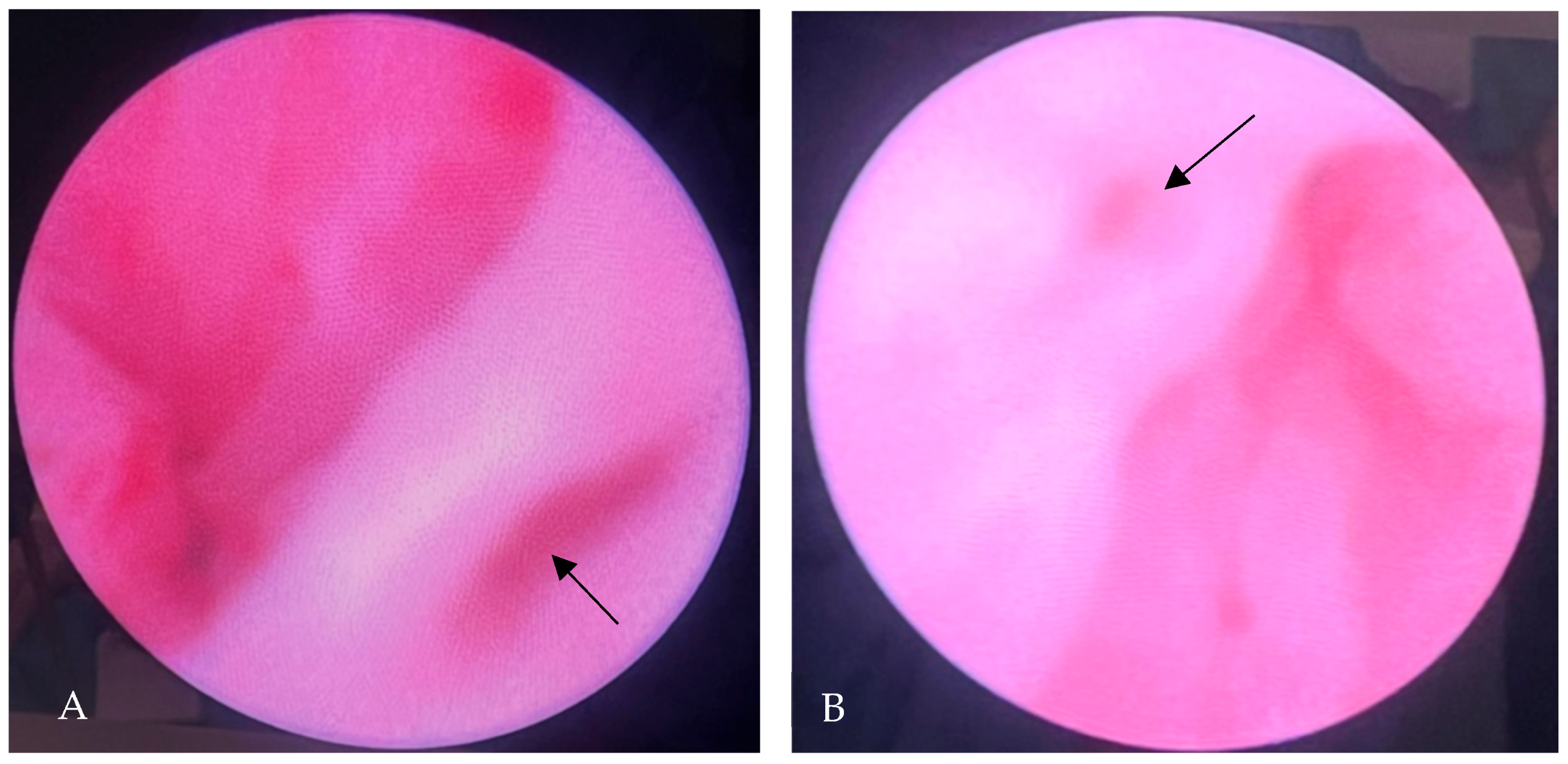 Diagnostics 15 01788 g005 Diagnostics 15 01788 g005