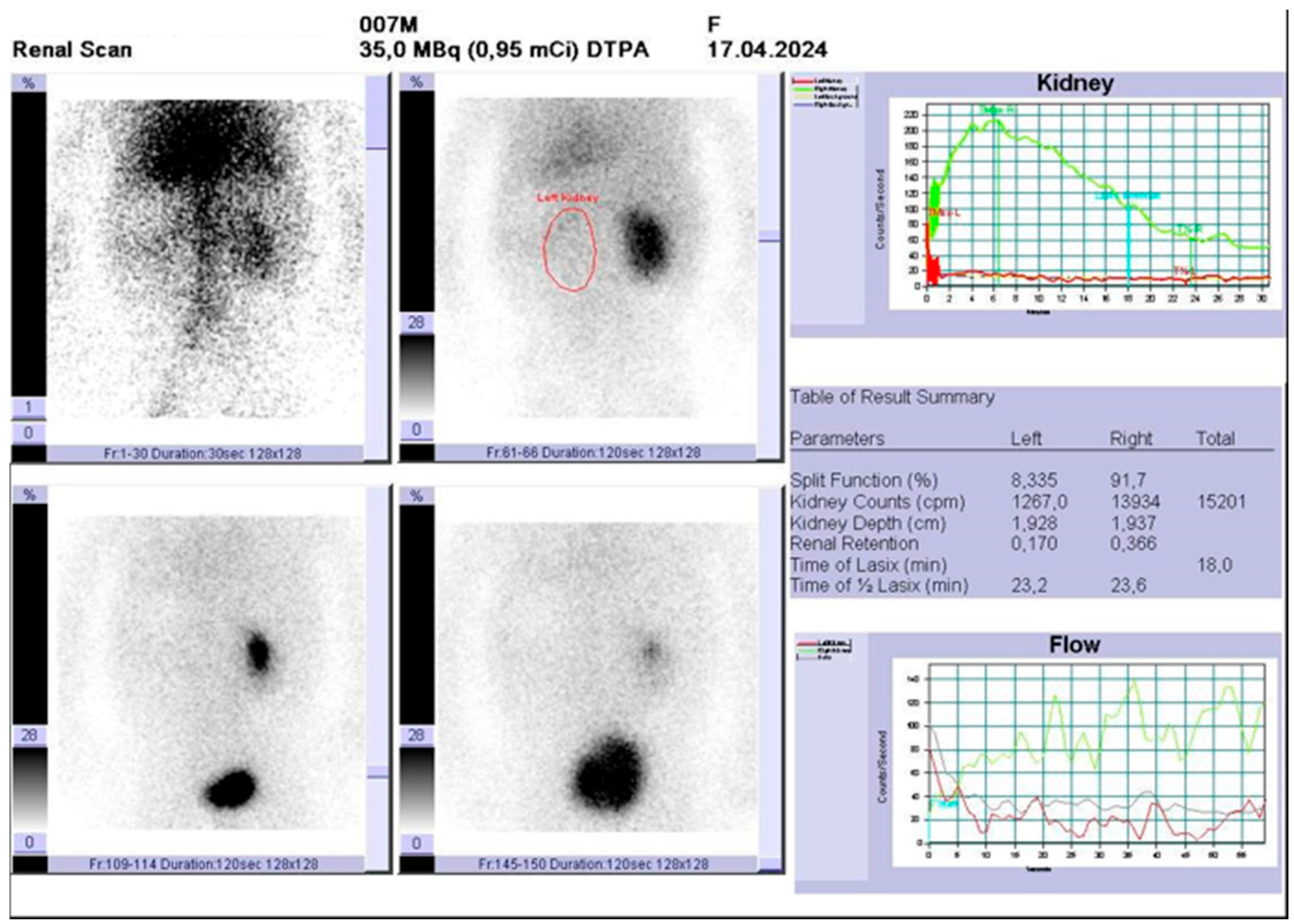 Diagnostics 15 01788 g006 Diagnostics 15 01788 g006