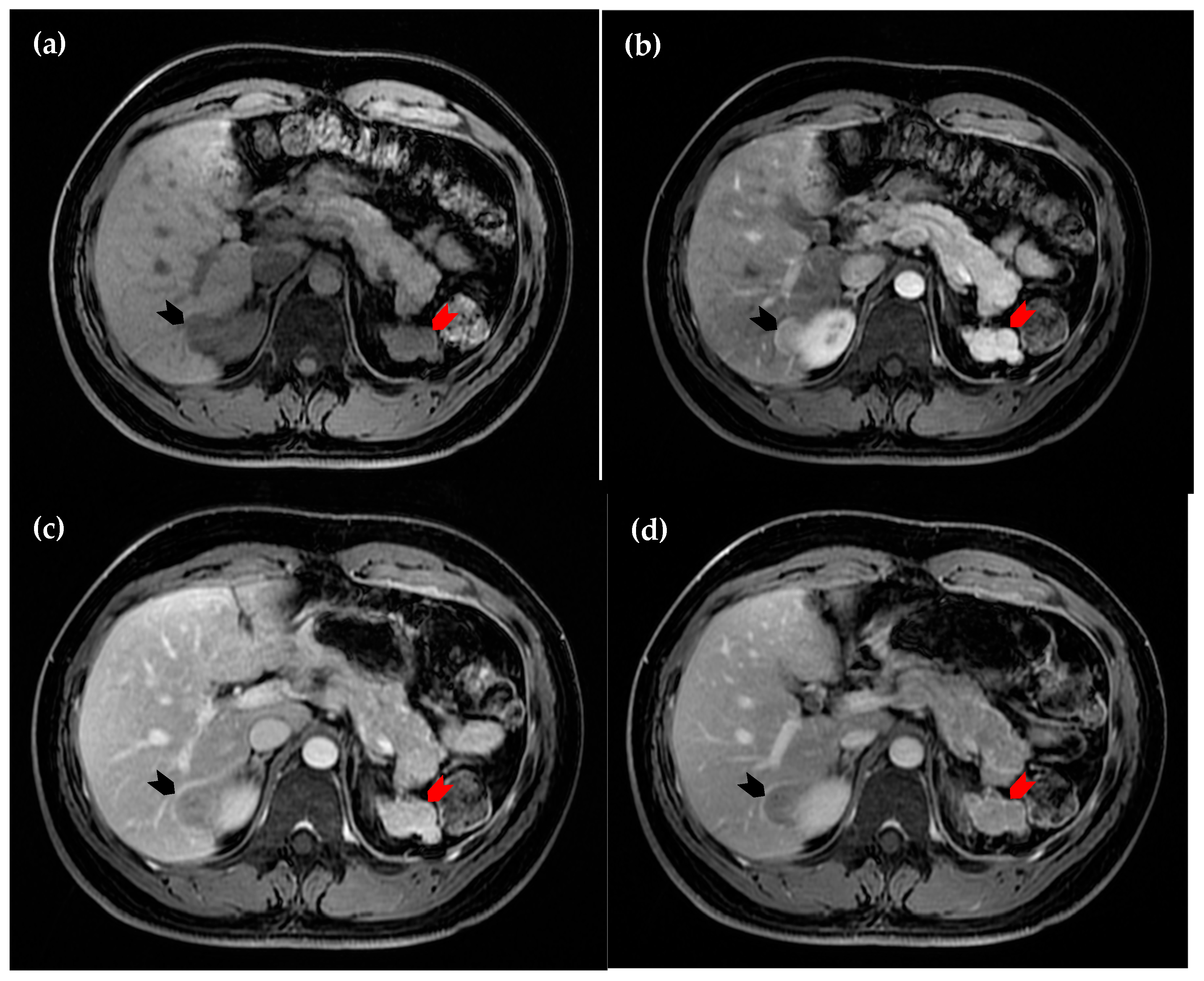 Diagnostics 15 01789 g003