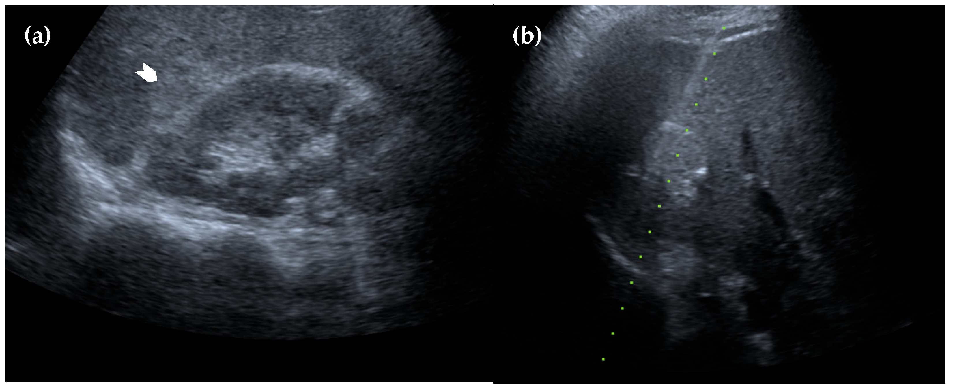 Diagnostics 15 01789 g004