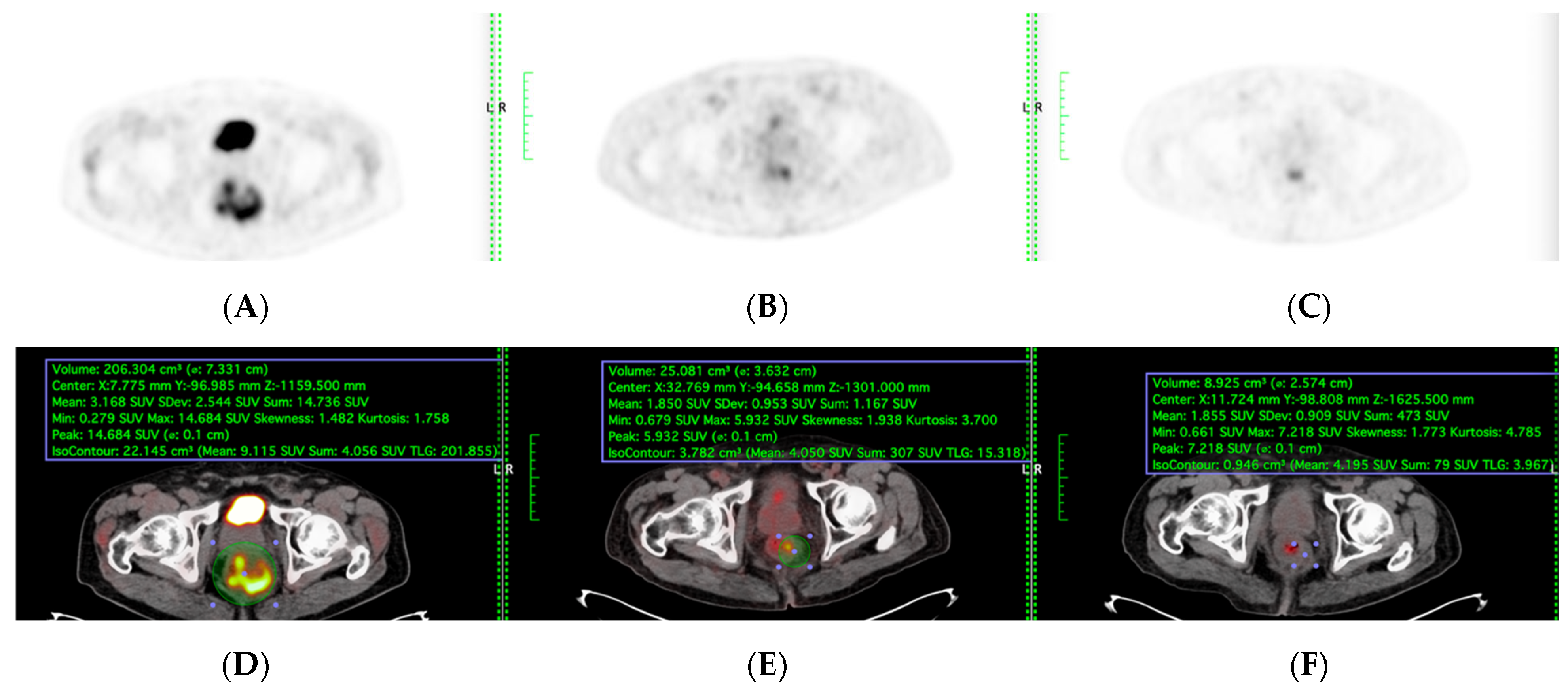 Diagnostics 15 01800 g002