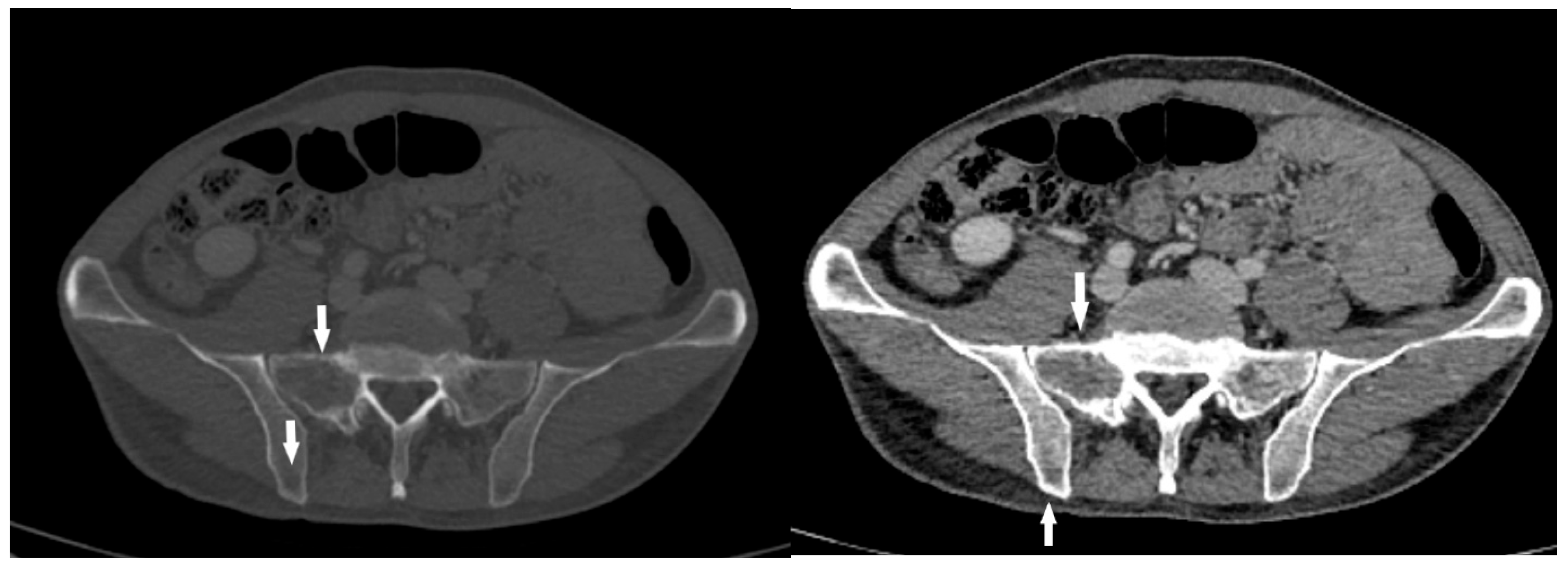 Diagnostics 15 01802 g004