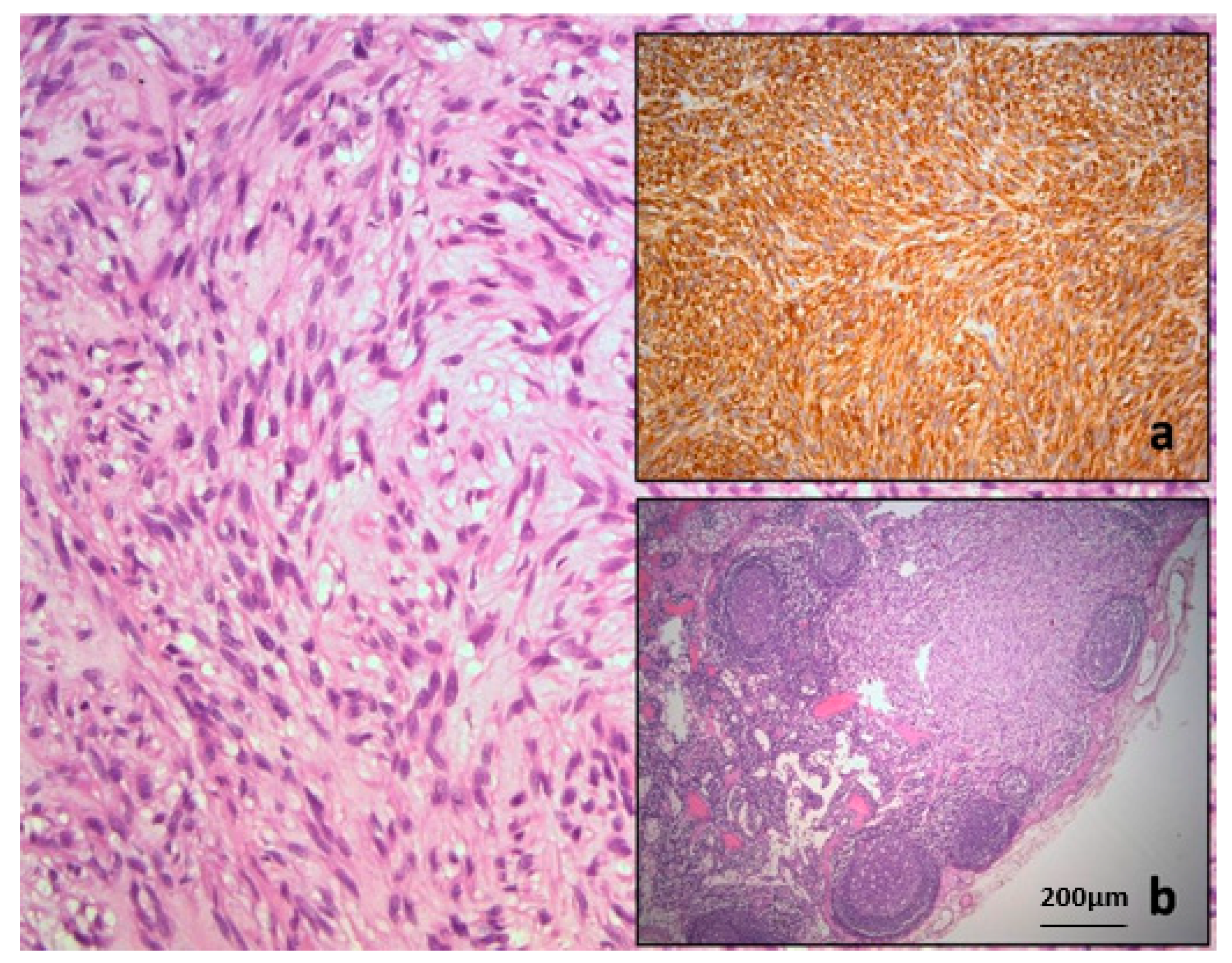 Diagnostics 15 01802 g005