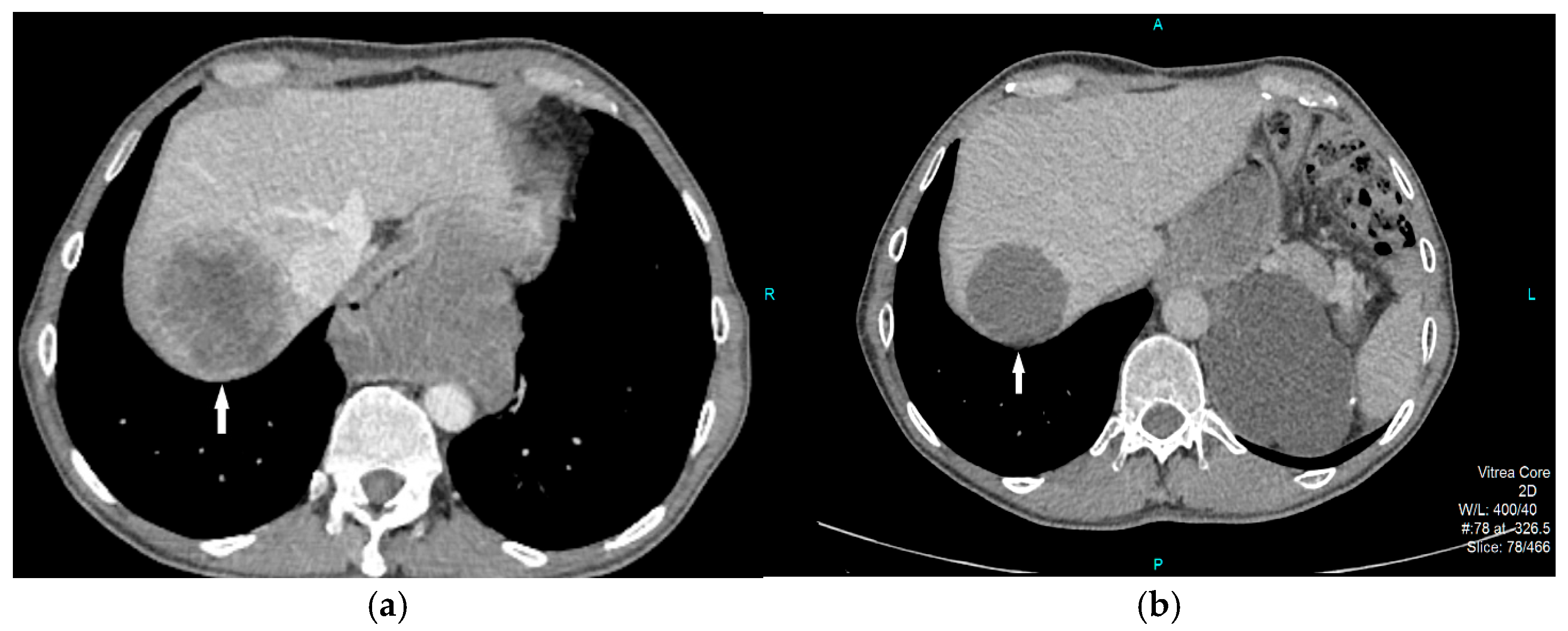 Diagnostics 15 01802 g006