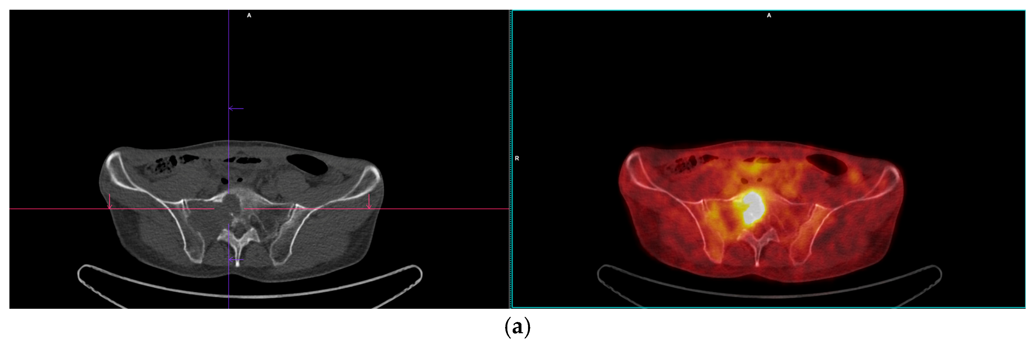 Diagnostics 15 01802 g008a