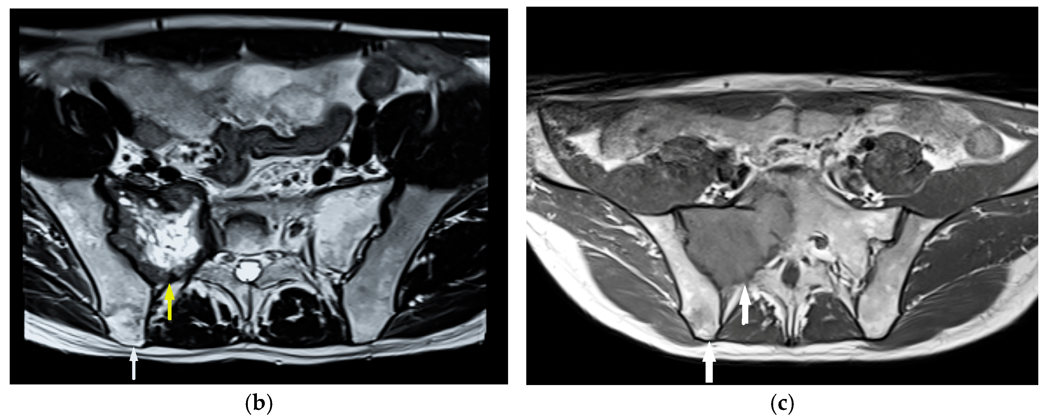 Diagnostics 15 01802 g008b