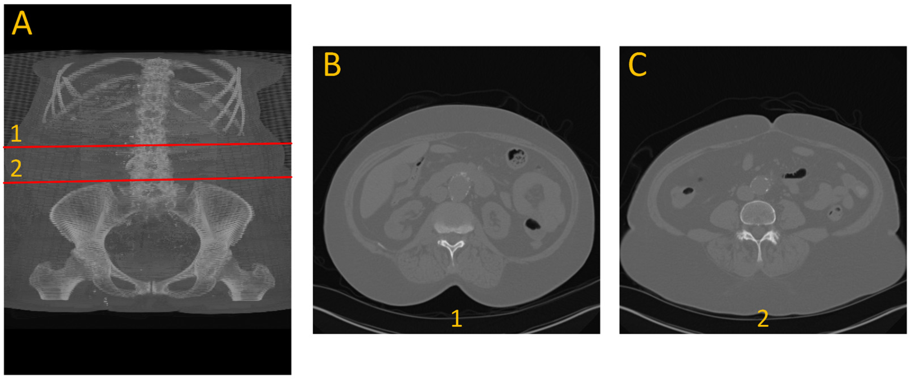 Diagnostics 15 01804 g001