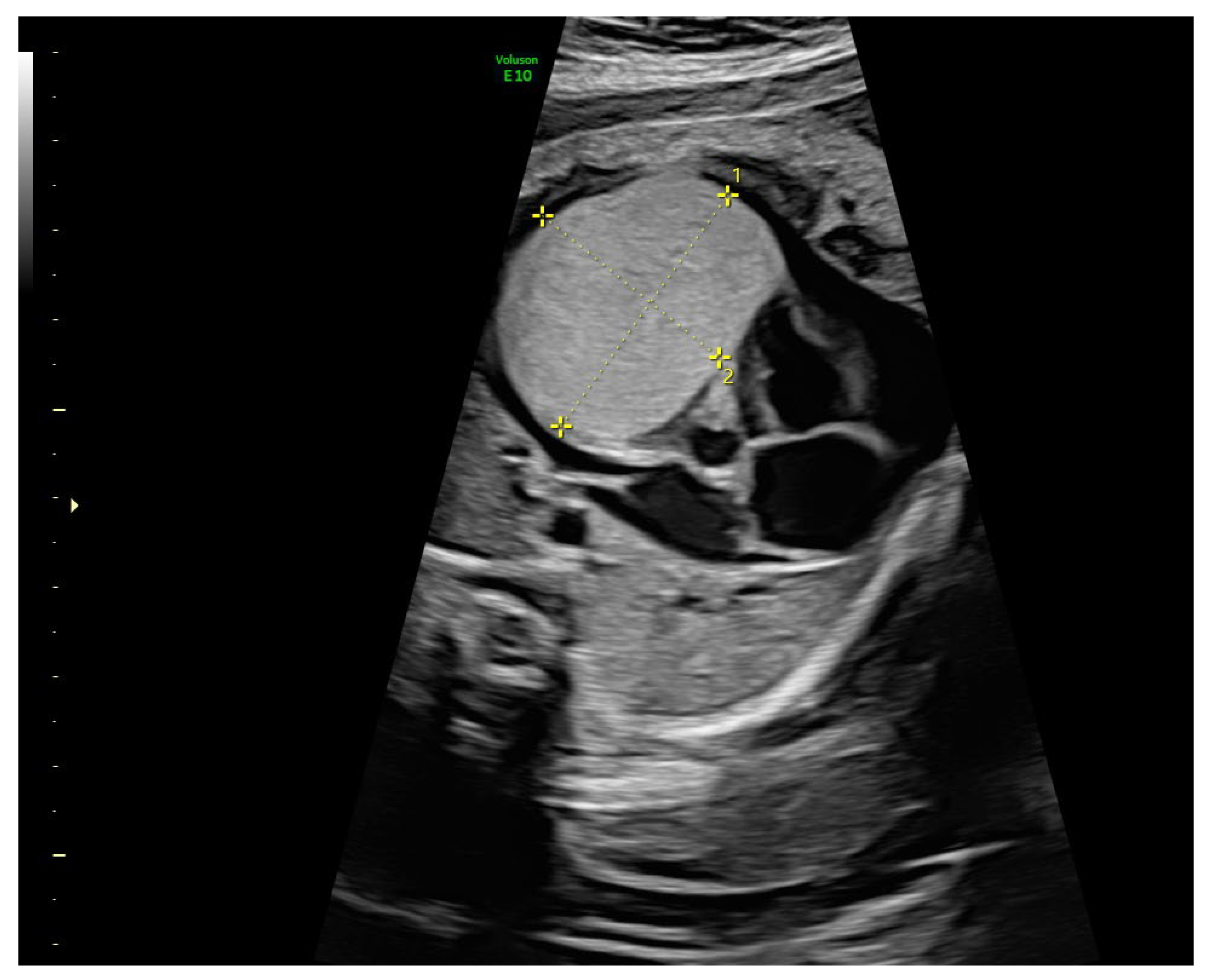 Diagnostics 15 01811 g001