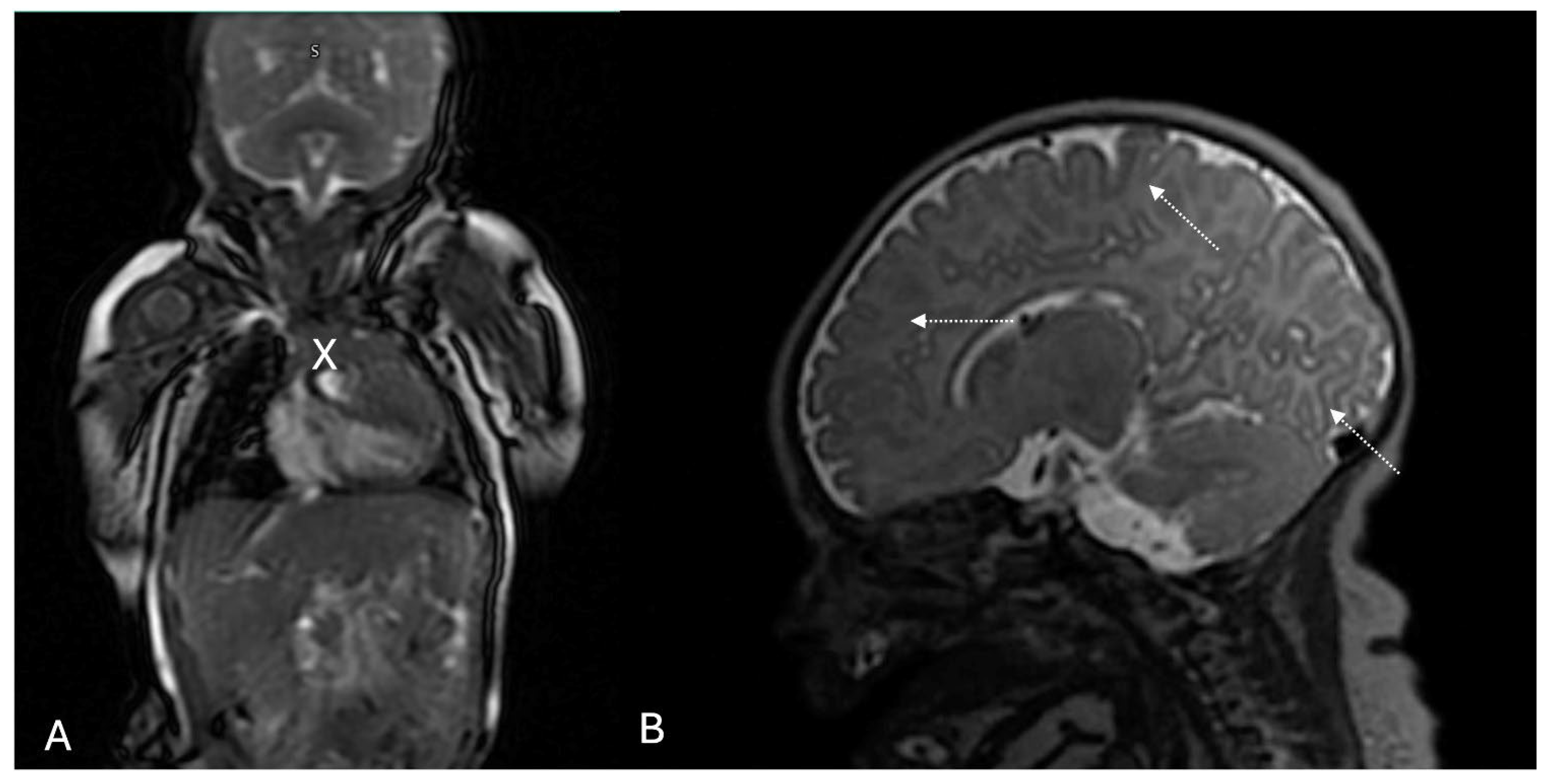 Diagnostics 15 01811 g002