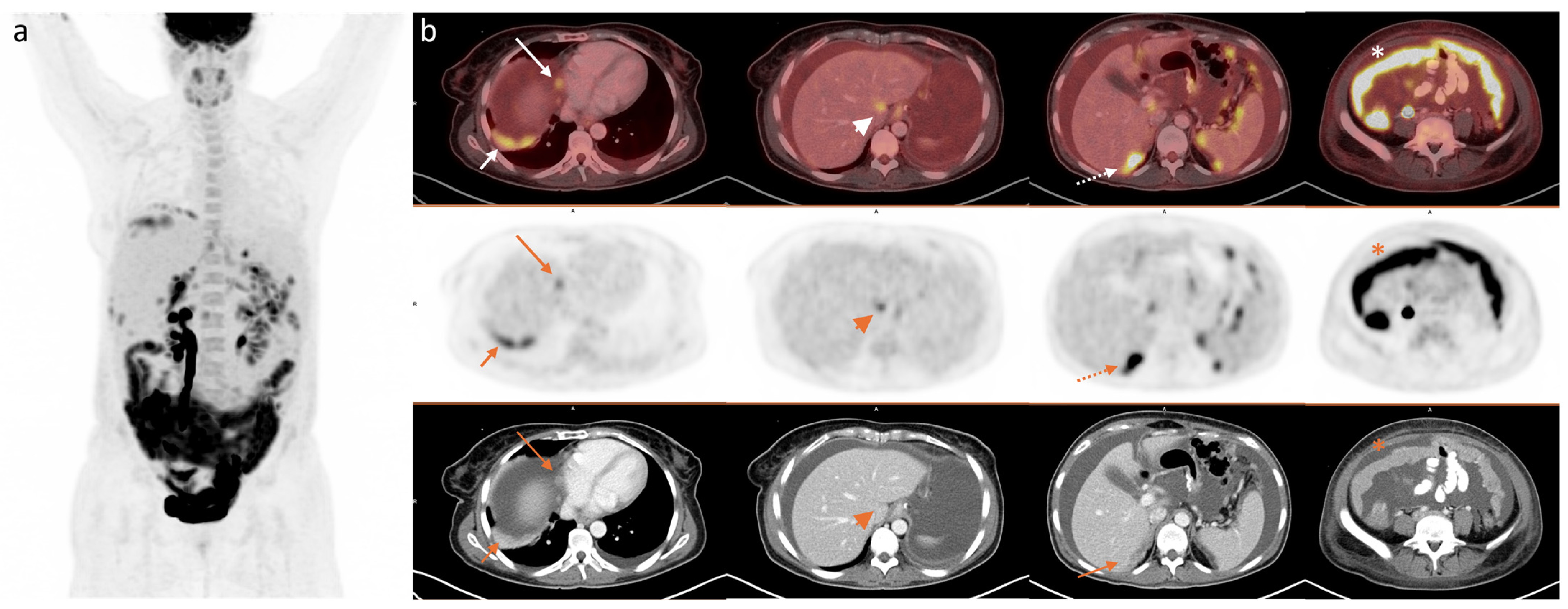 Diagnostics 15 01818 g001