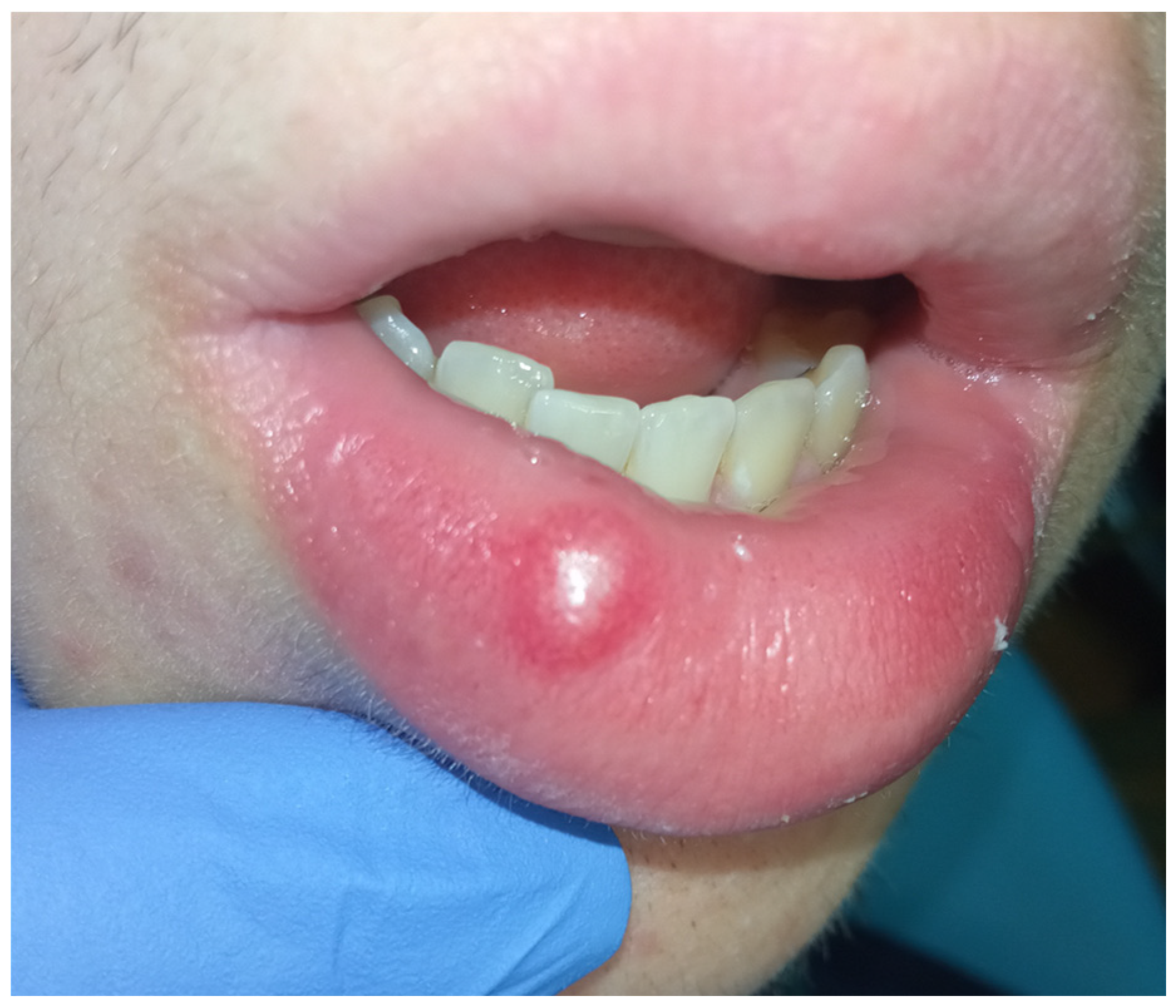 Diagnostics 15 01825 g001 Diagnostics 15 01825 g001