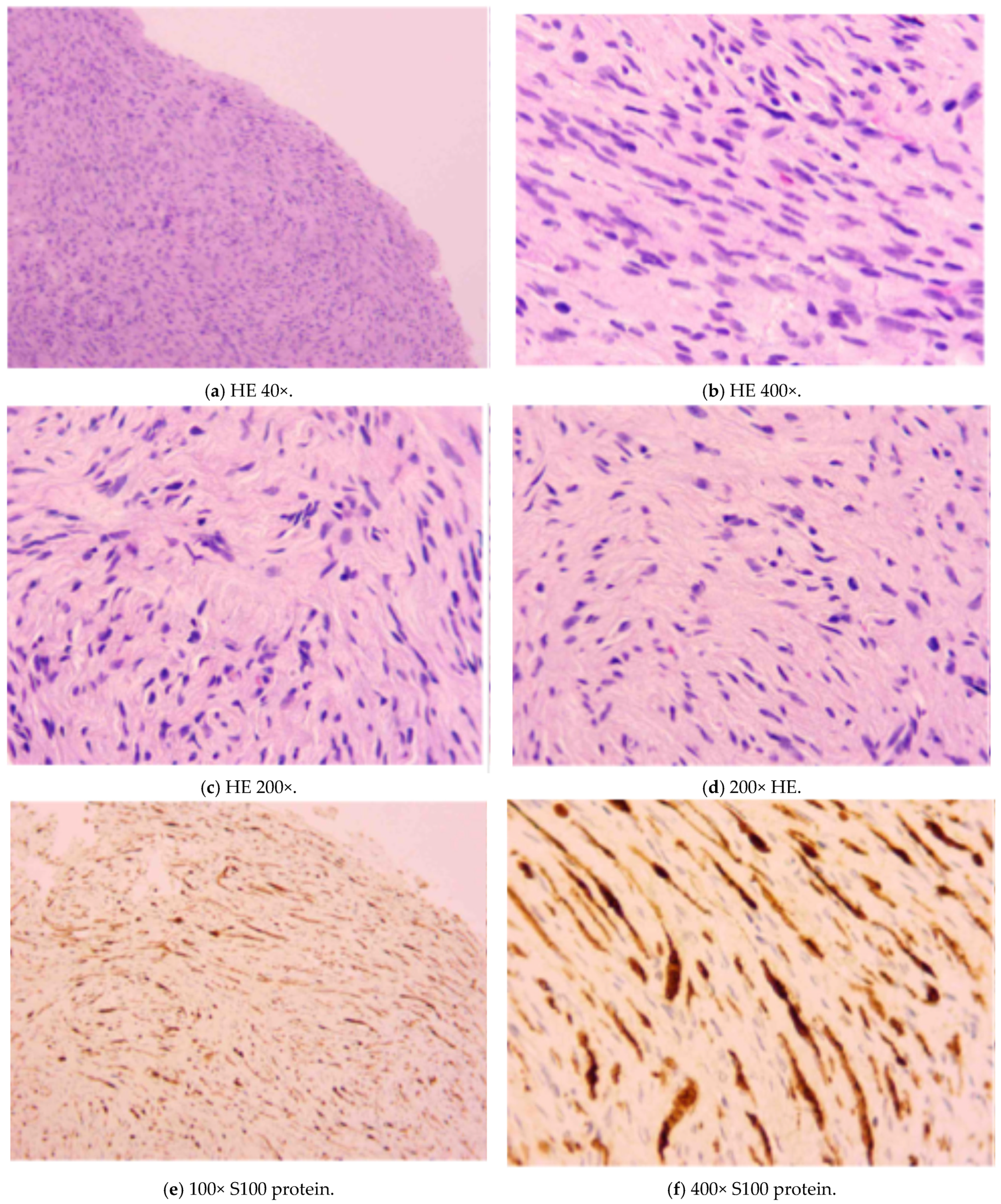 Diagnostics 15 01825 g003 Diagnostics 15 01825 g003