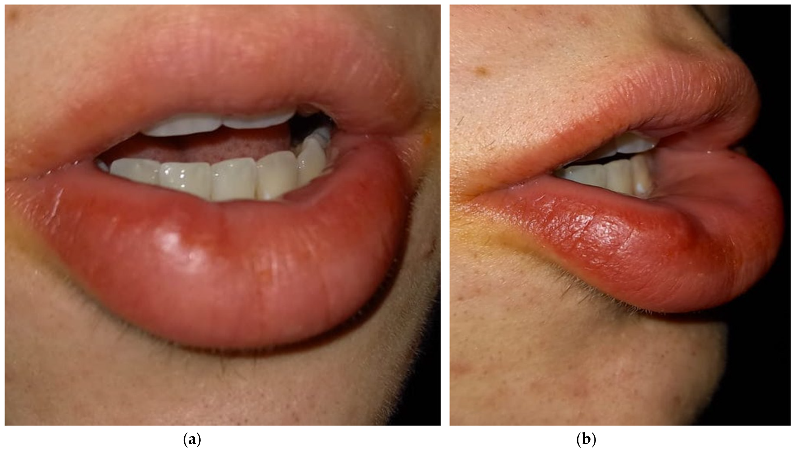 Diagnostics 15 01825 g004 Diagnostics 15 01825 g004