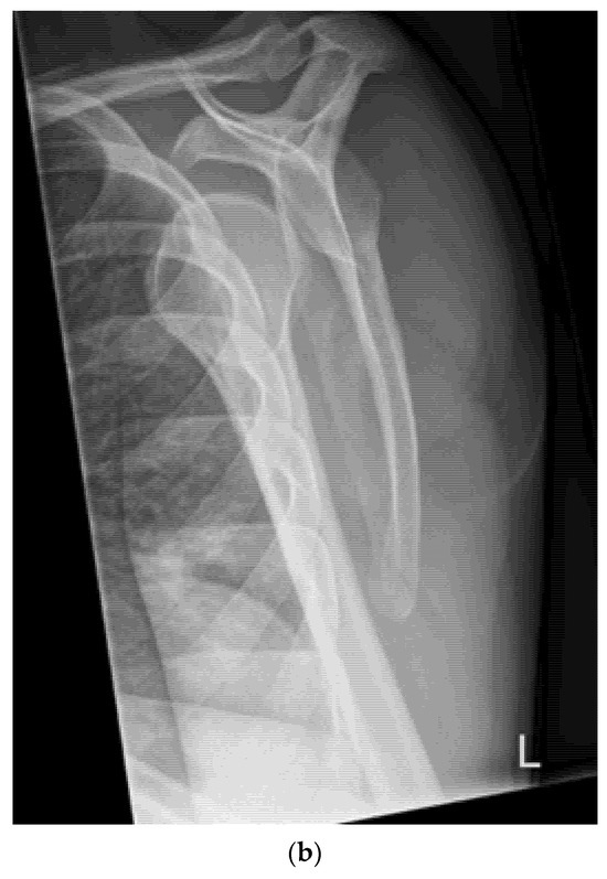 A Plea for a Paradigm Shift from X-Ray to Ultrasound in