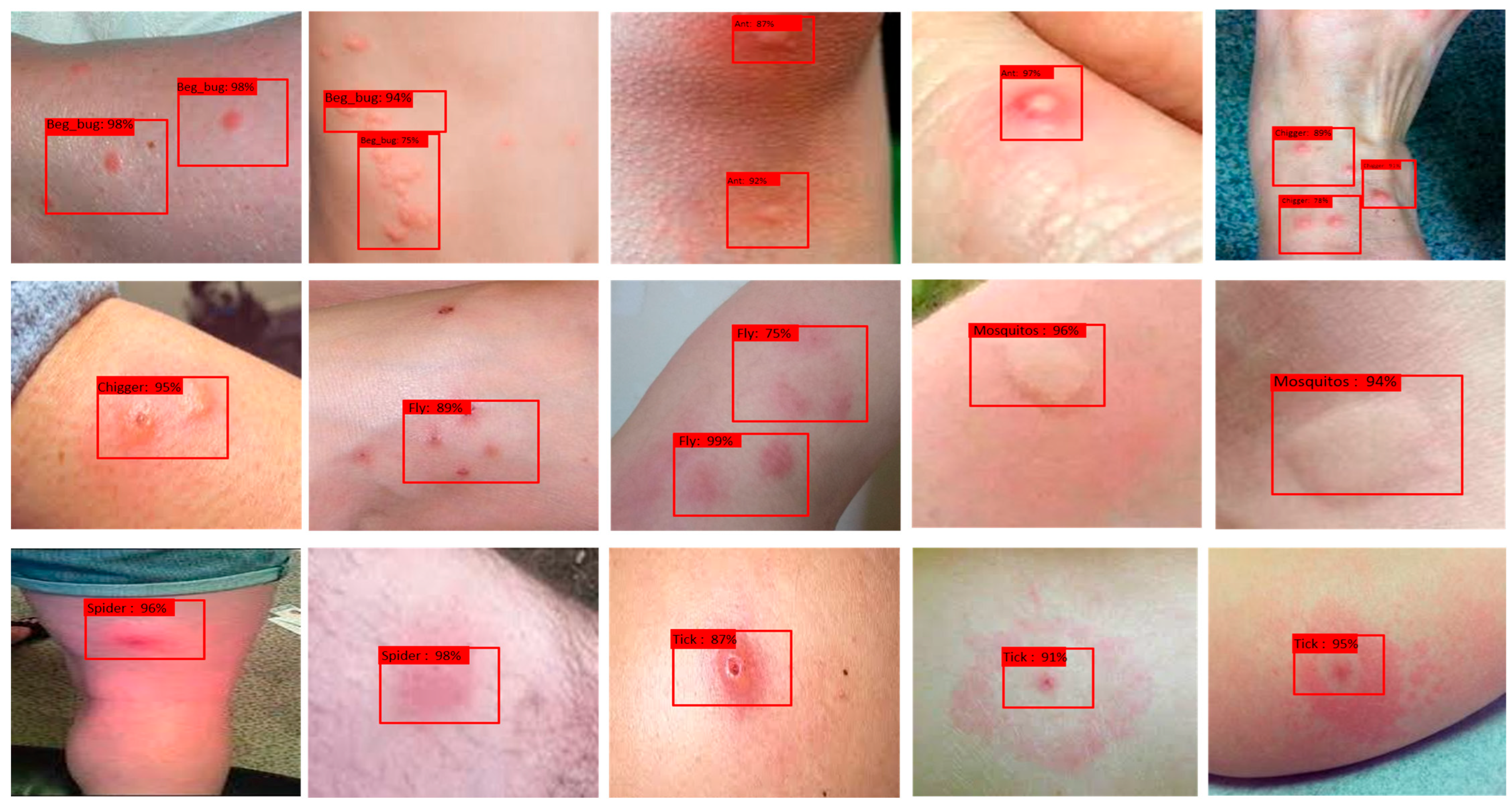 Diagnostics 15 01841 g004