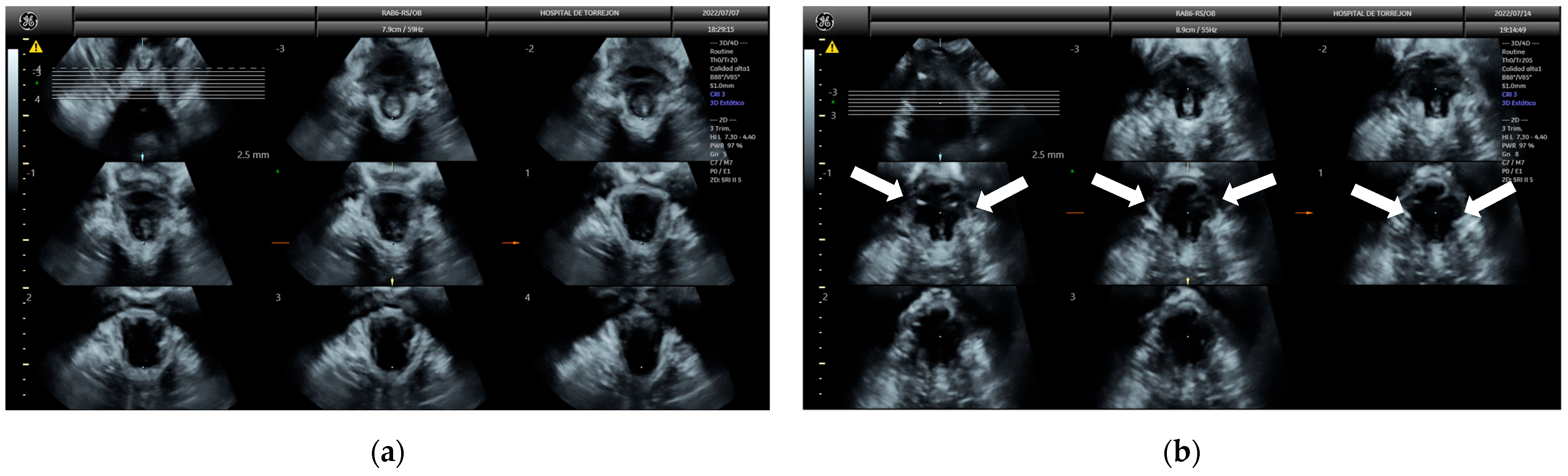 Diagnostics 15 01853 g003