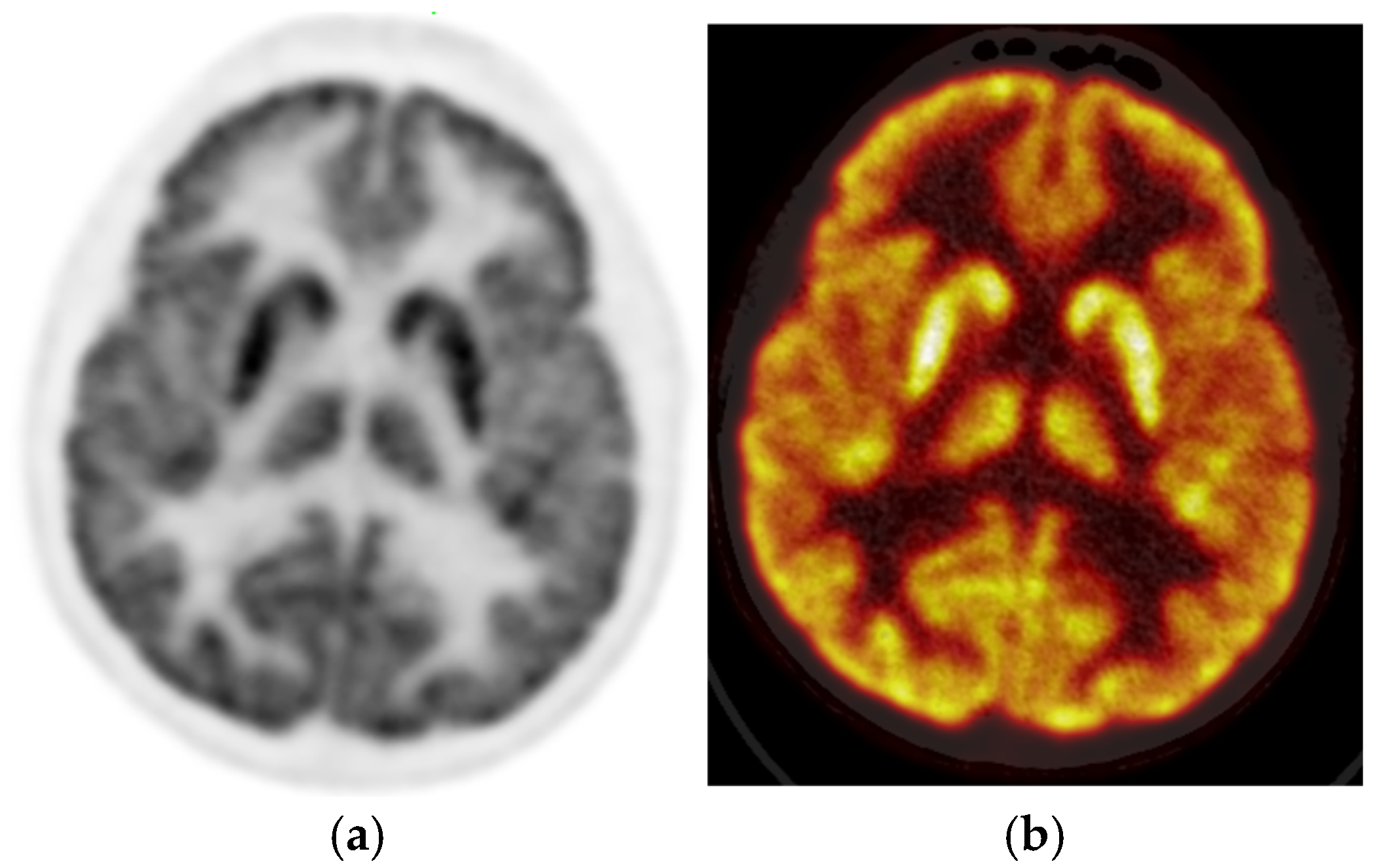 Diagnostics 15 01865 g002
