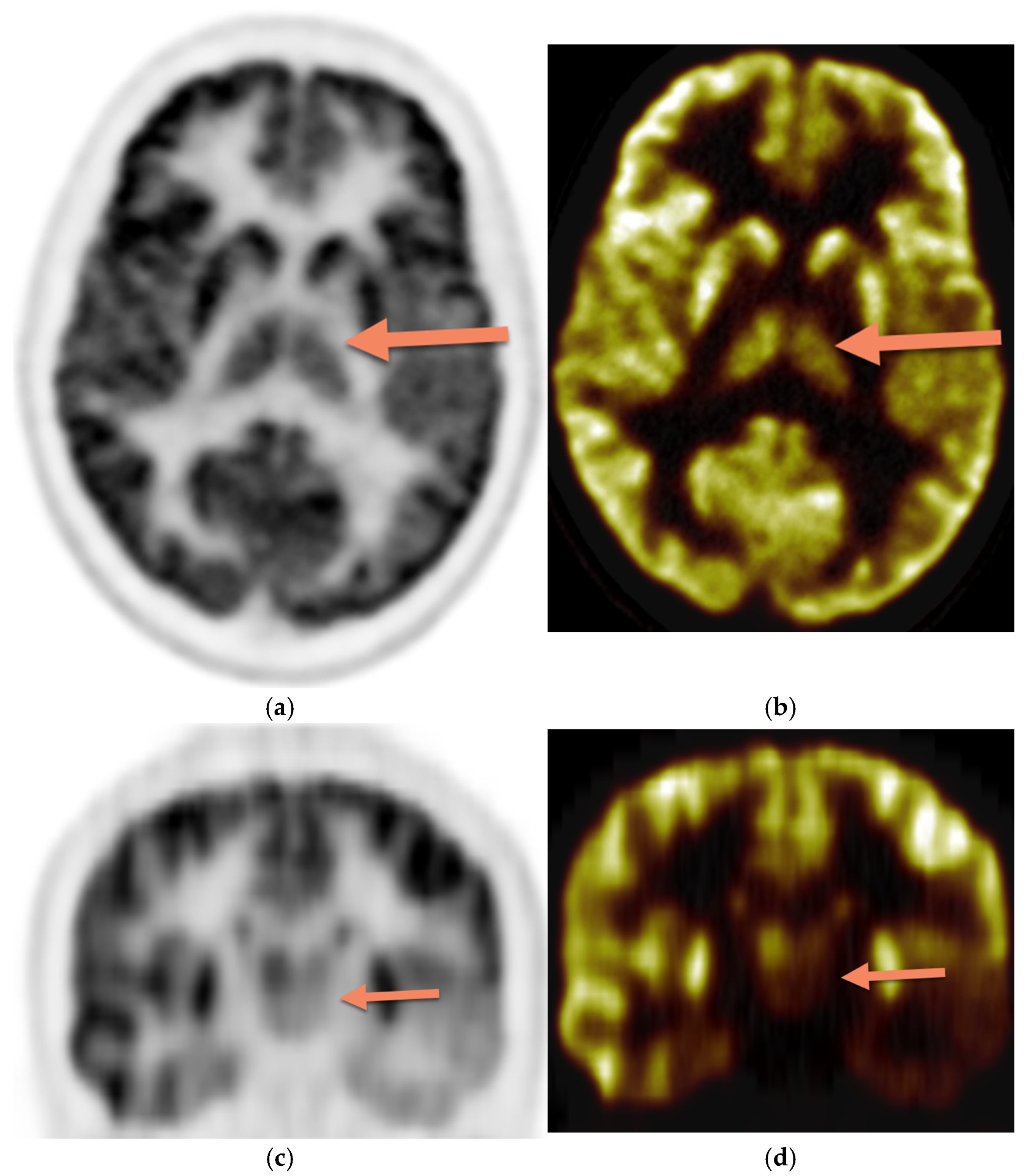 Diagnostics 15 01865 g003
