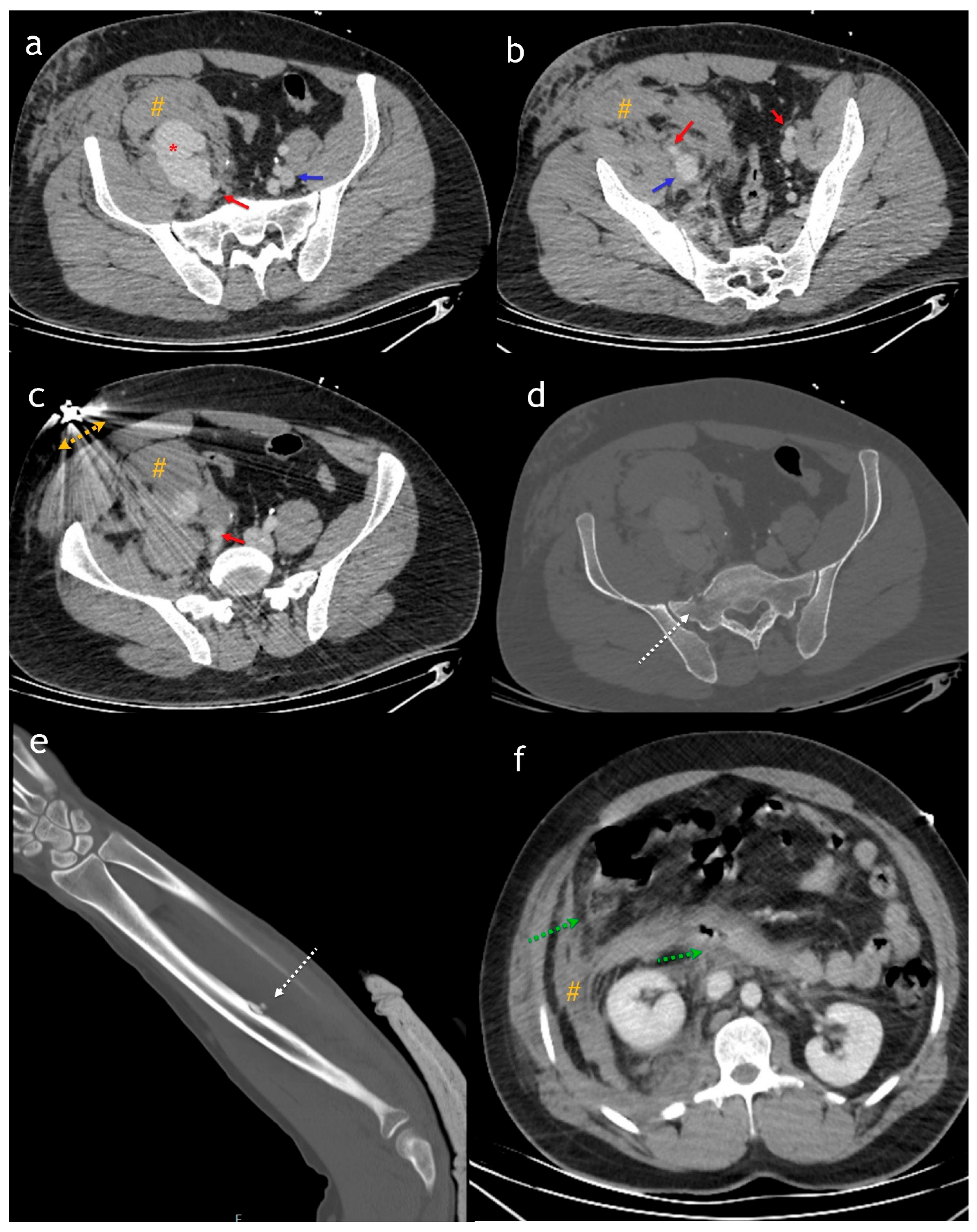 Diagnostics 15 01882 g001