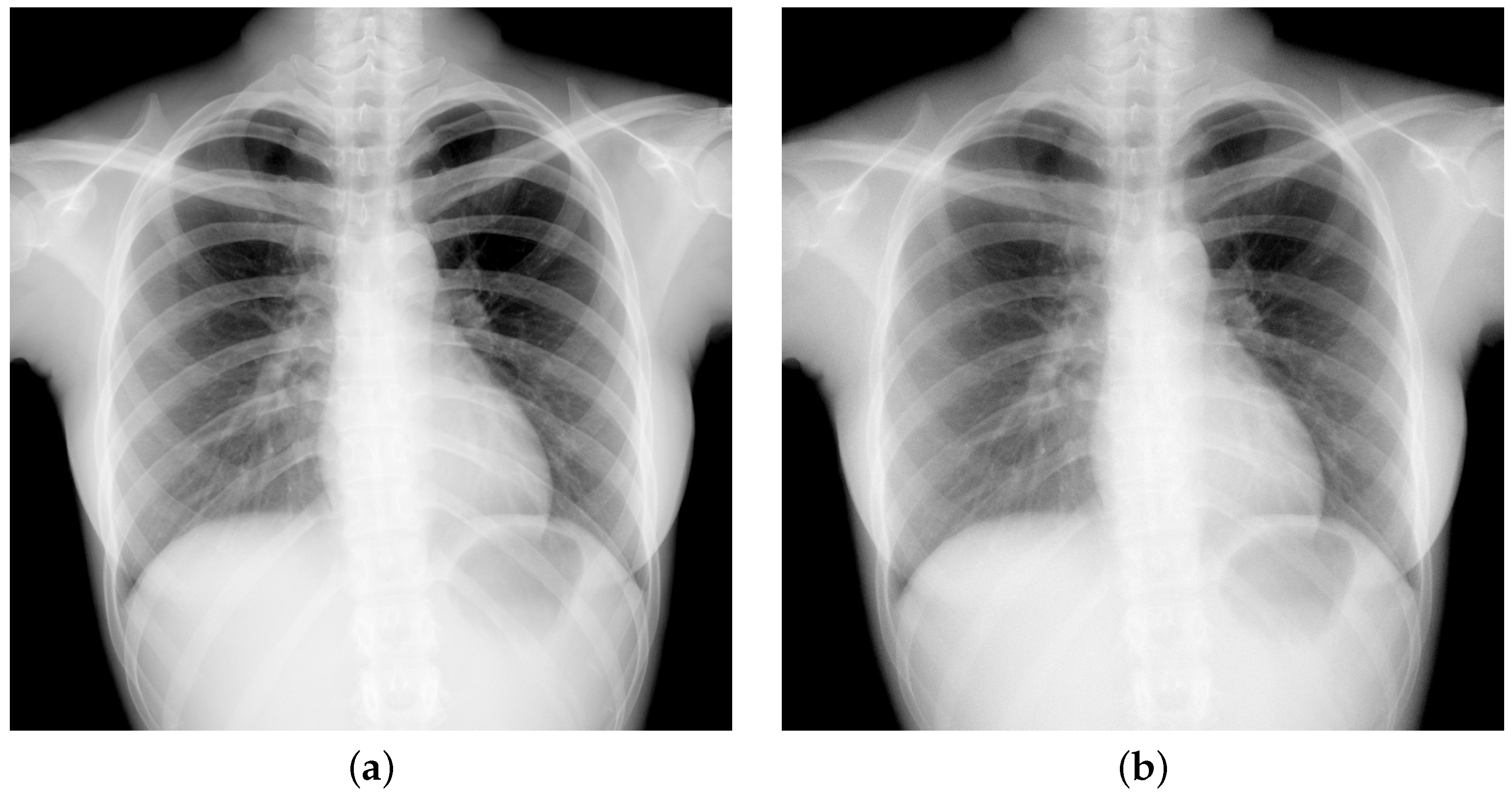 Diagnostics 15 01889 g002