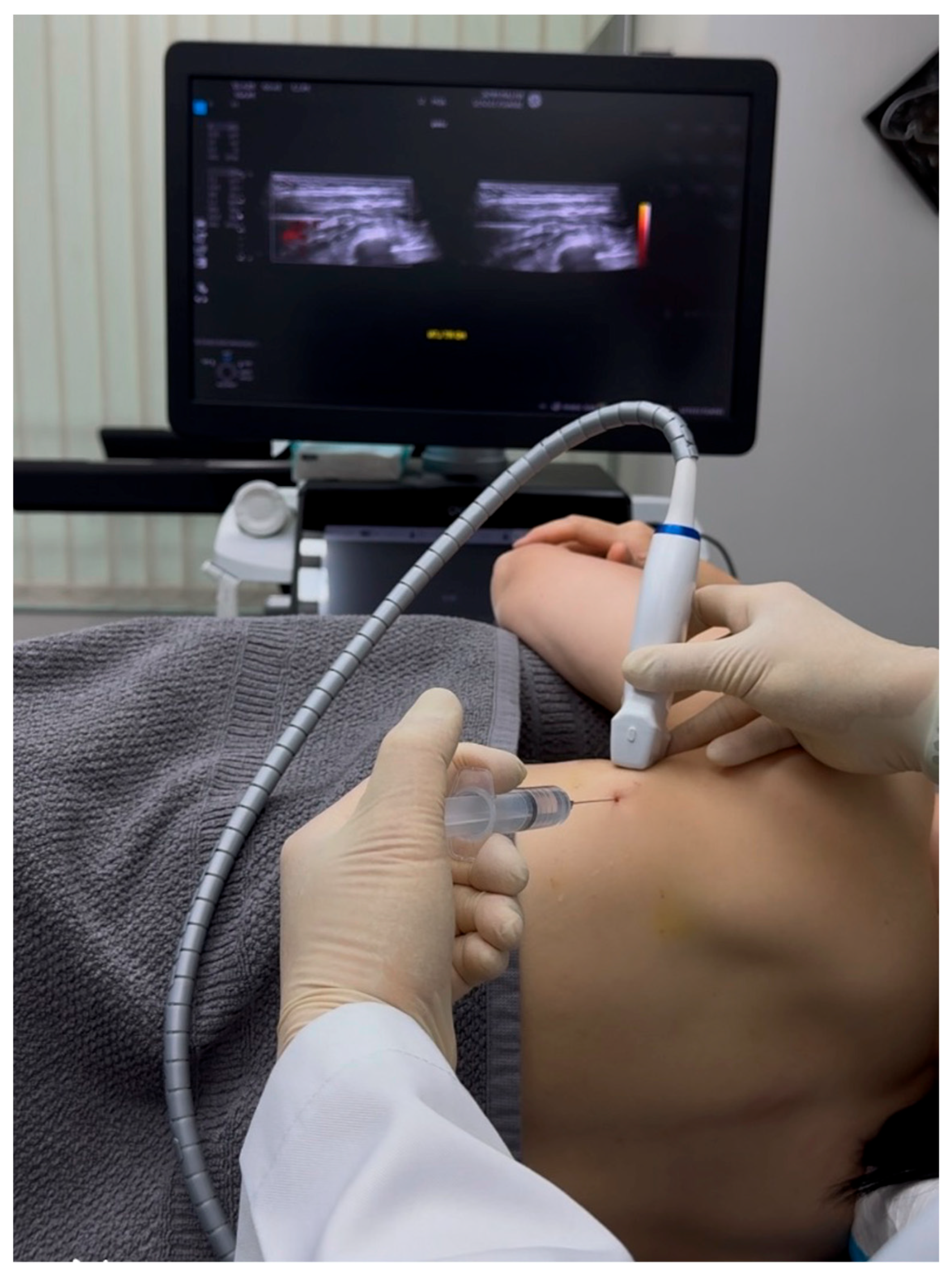 Diagnostics 15 01891 g004