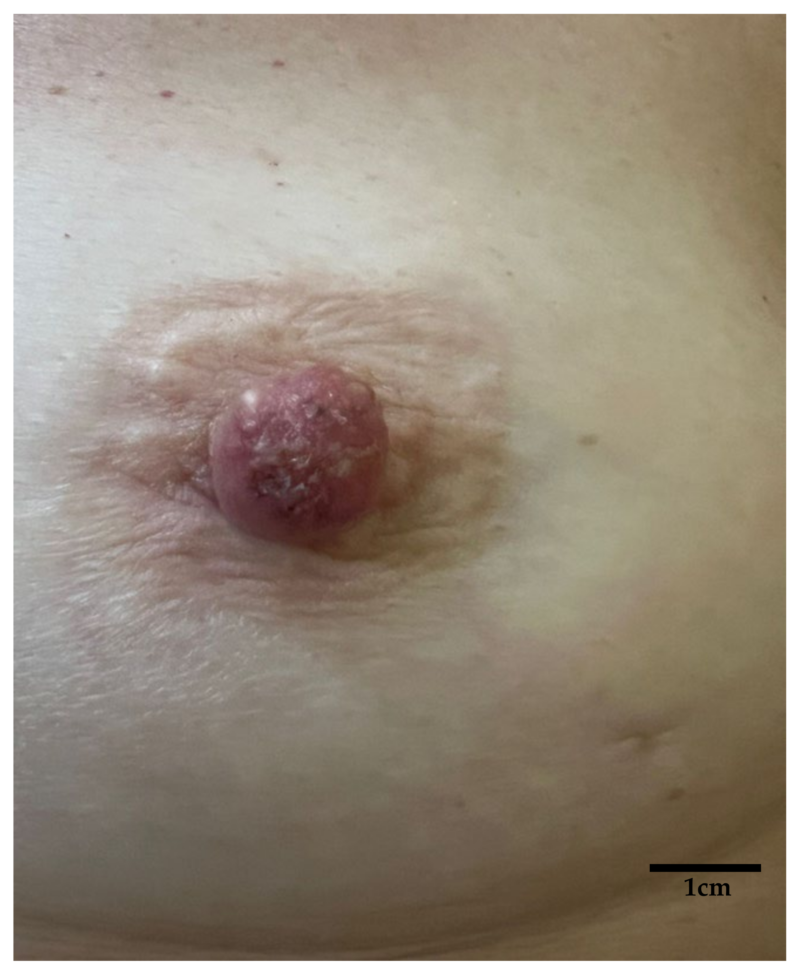 Diagnostics 15 01898 g001