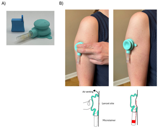 Evaluation of a Simplified Upper Arm Device for Vacuum-Assisted ...