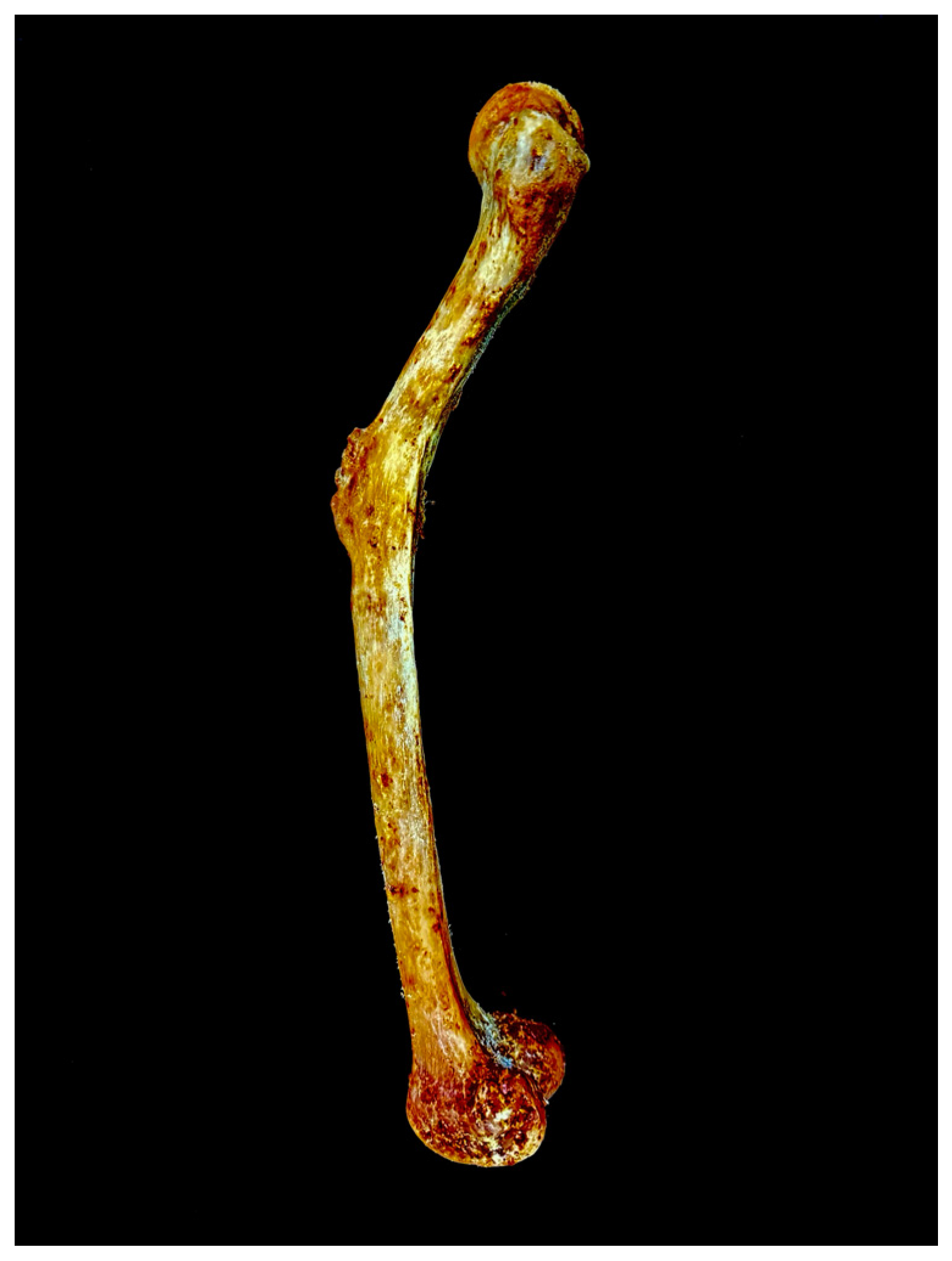 Diagnostics 15 01943 g001