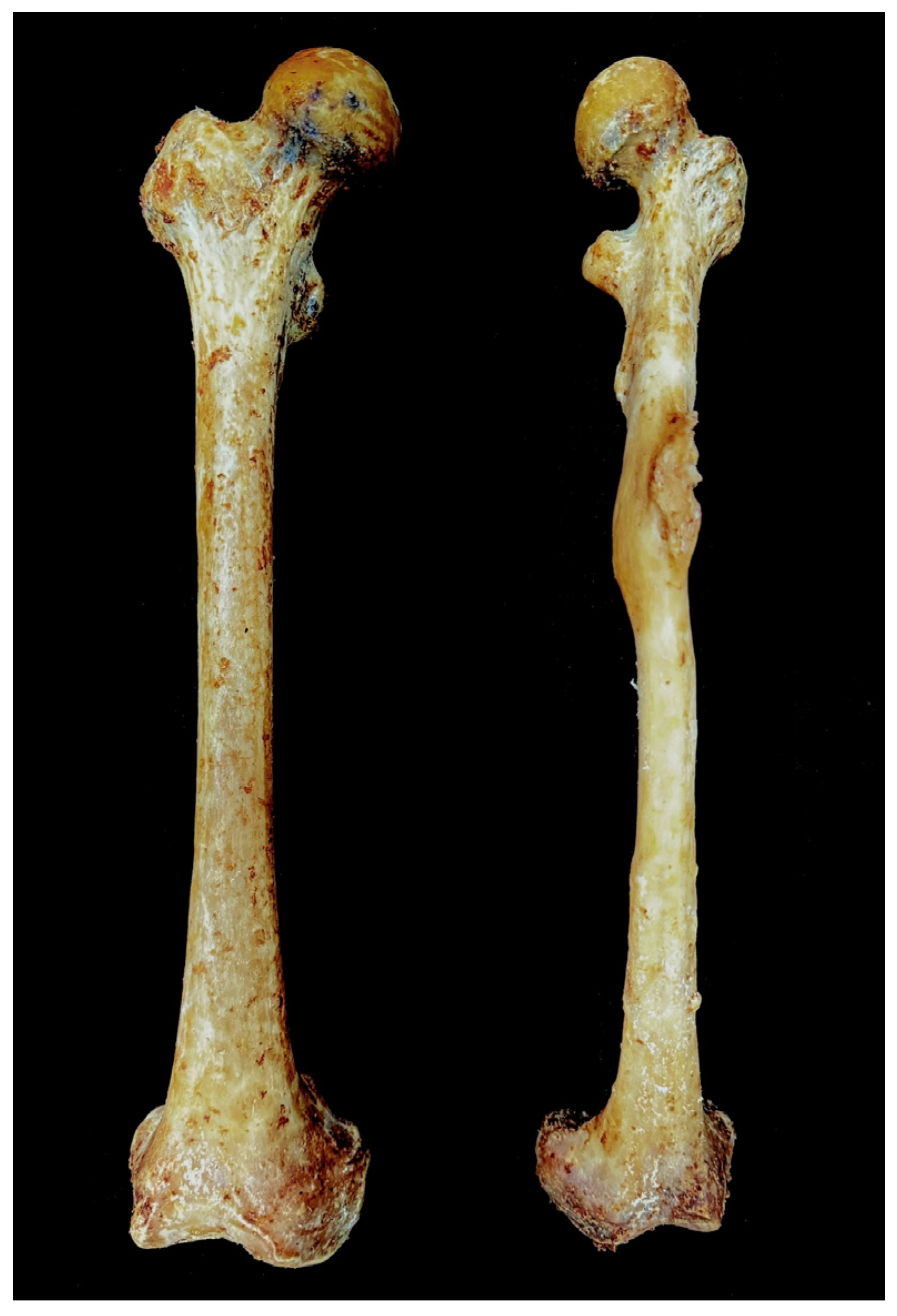 Diagnostics 15 01943 g002