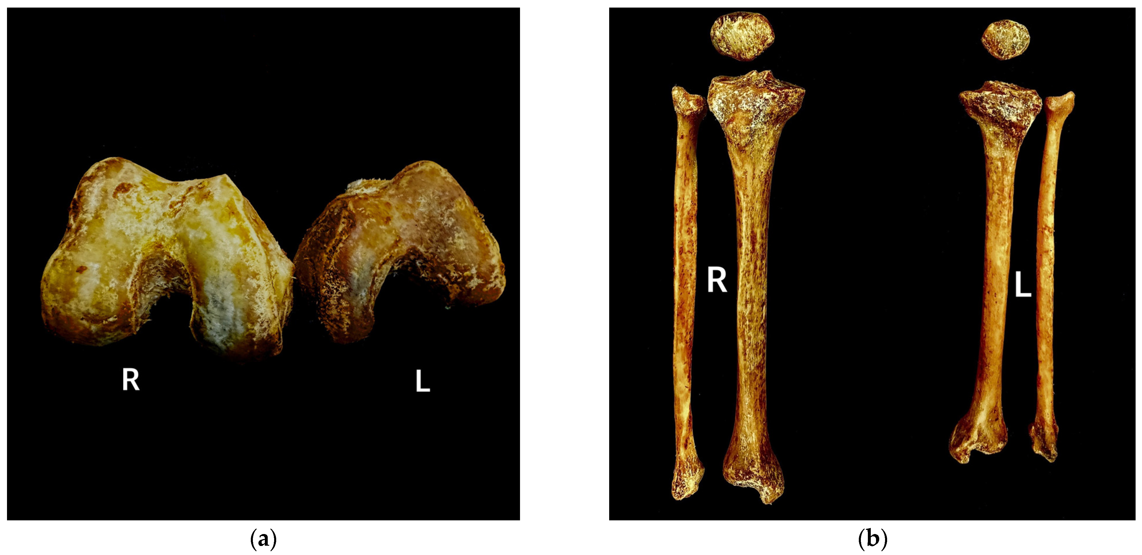 Diagnostics 15 01943 g003