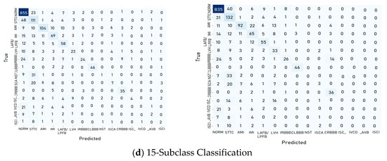 Interpretable Deep Learning Models for Arrhythmia Classification Based ...