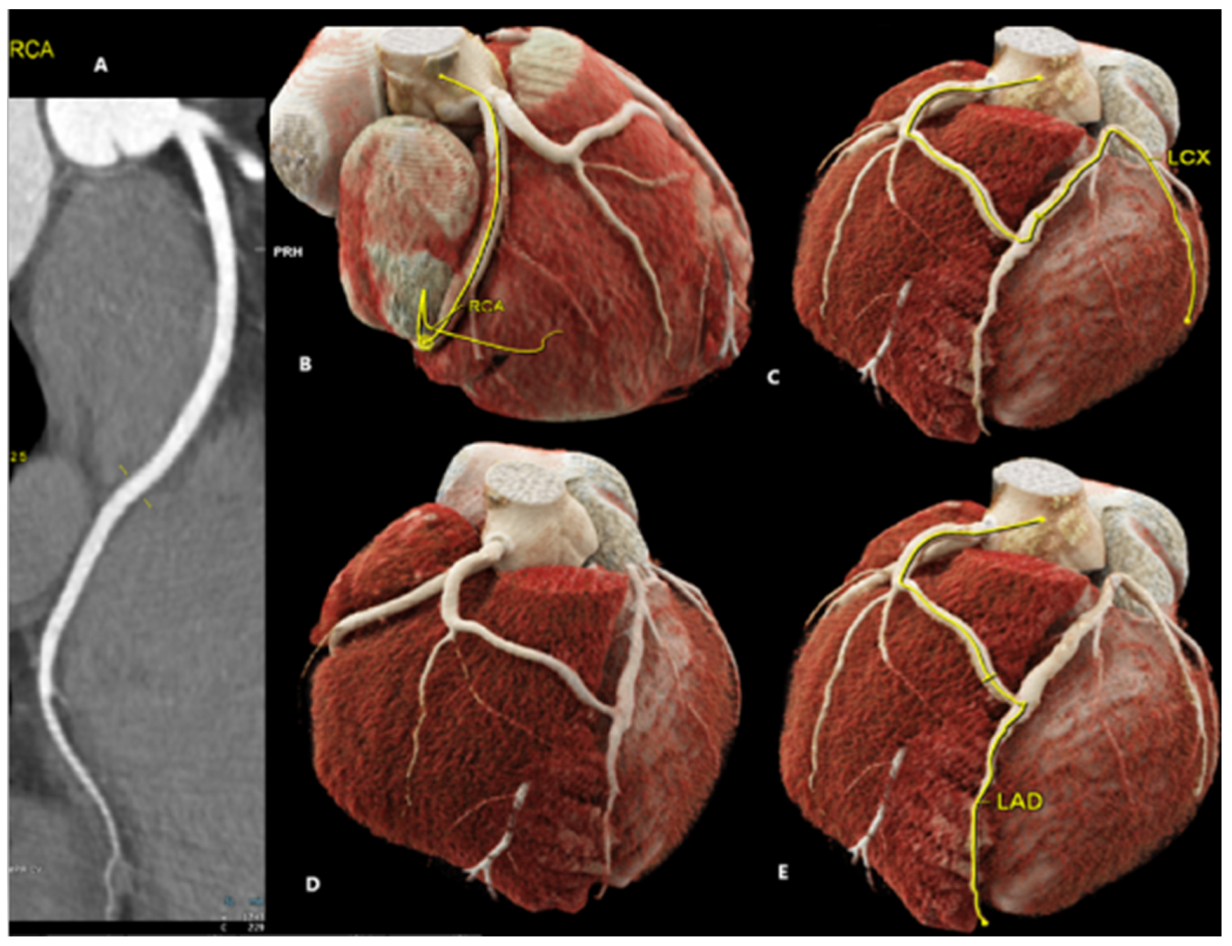 Diagnostics 15 01971 g001