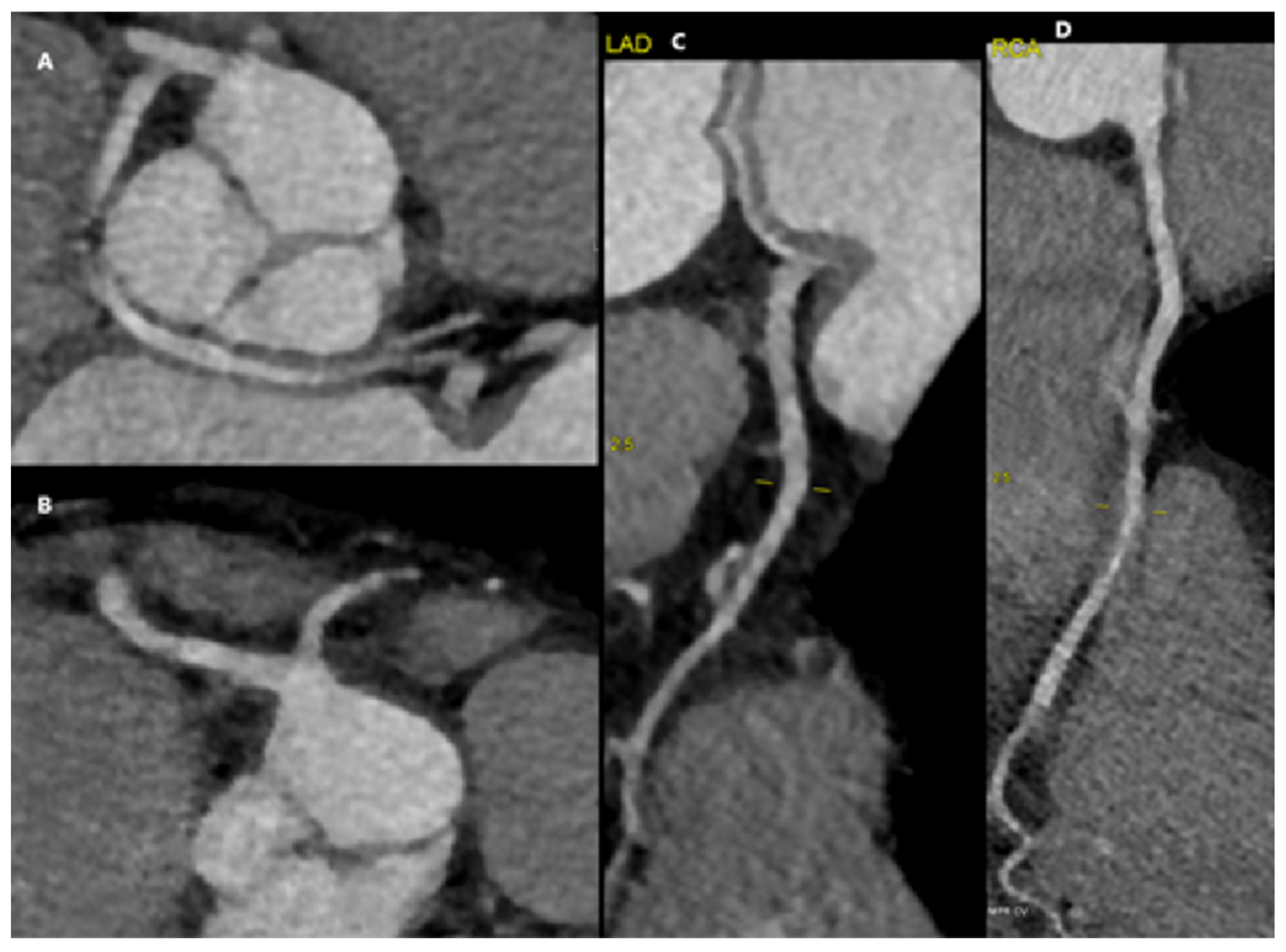 Diagnostics 15 01971 g004