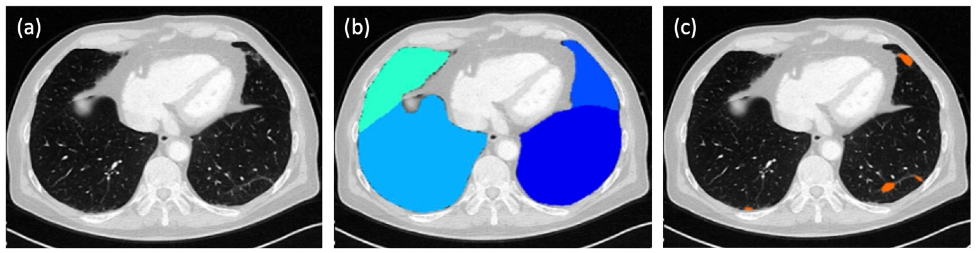 Diagnostics 15 01987 g001