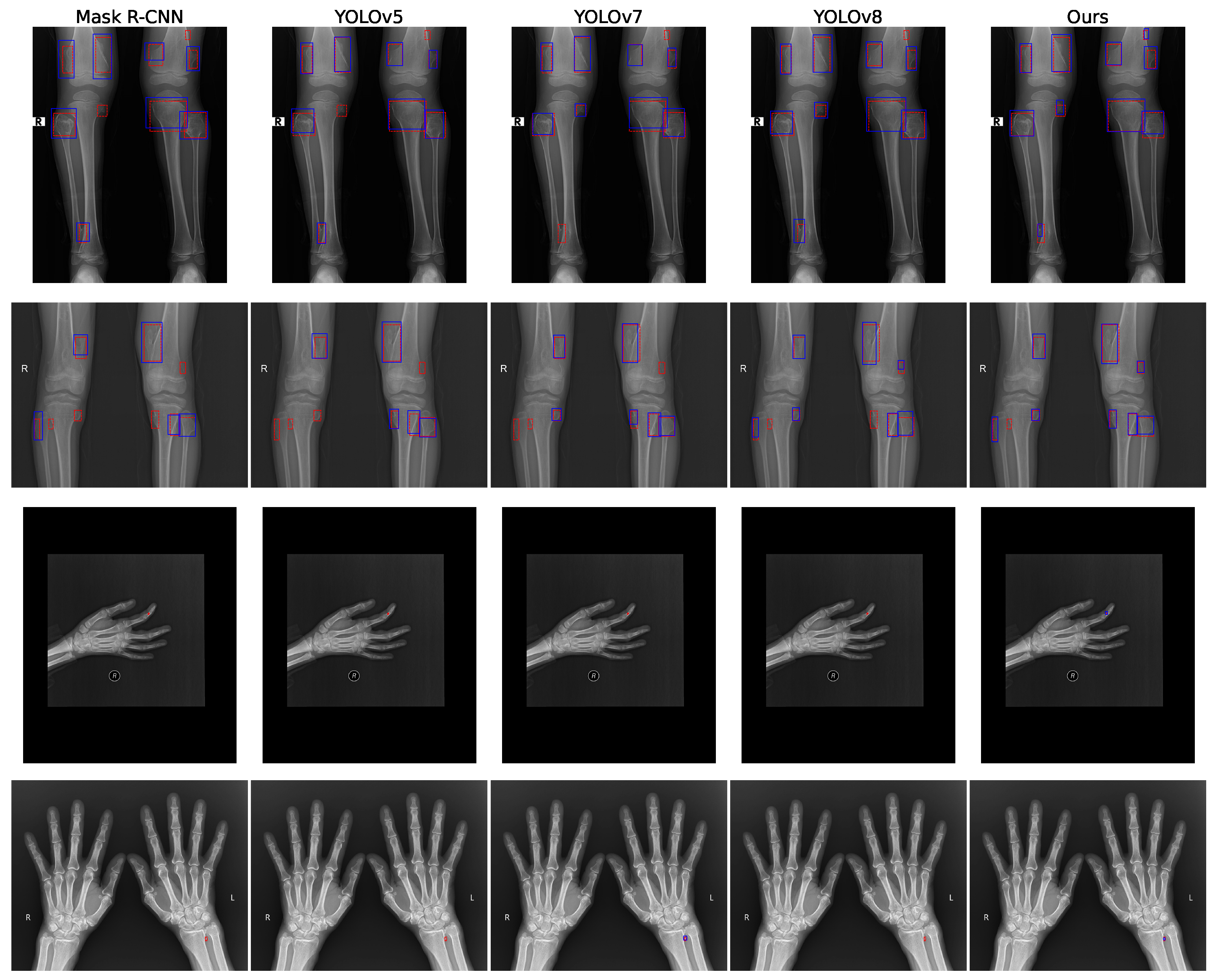 Diagnostics 15 01988 g005 Diagnostics 15 01988 g005